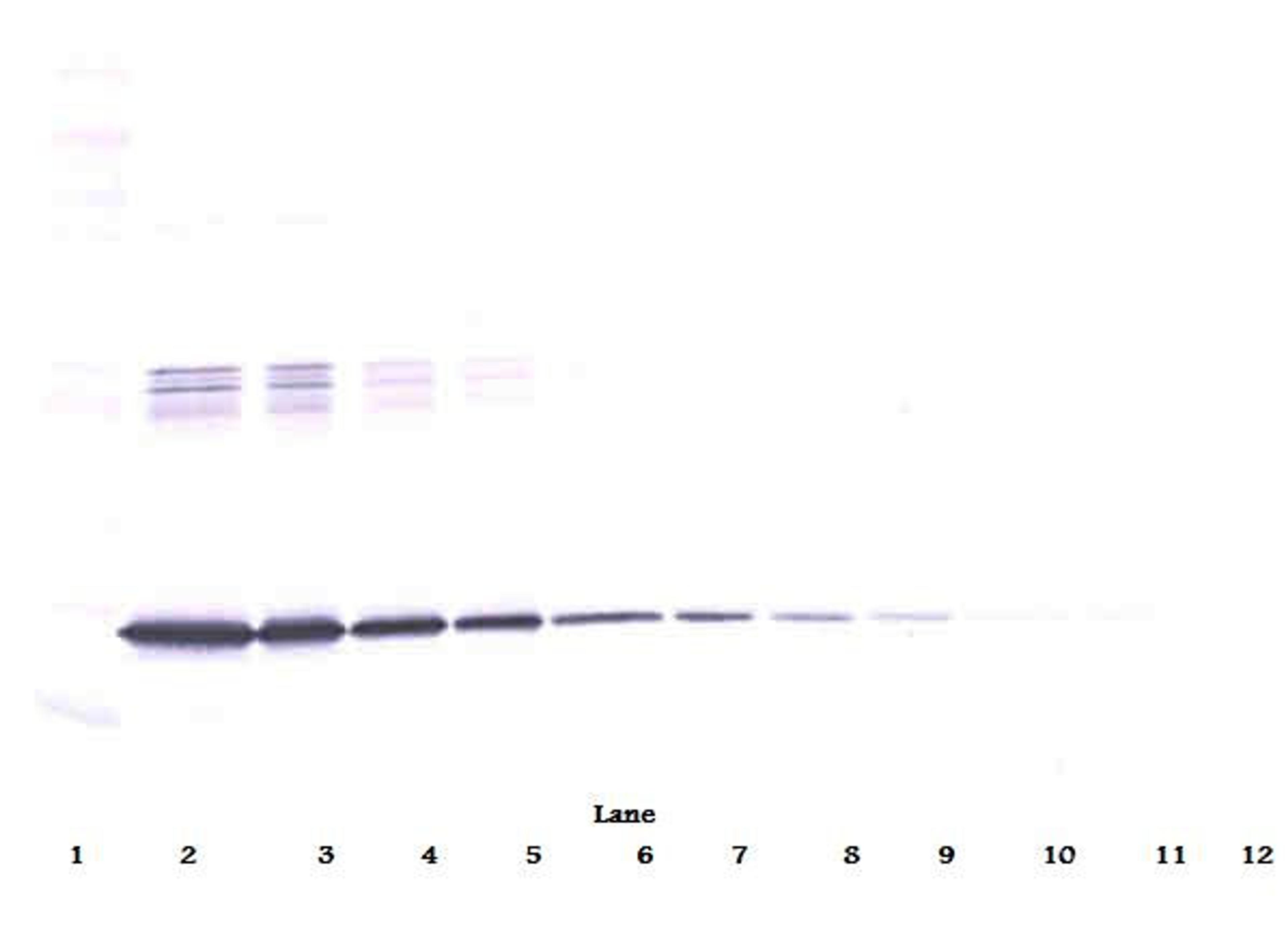 To detect hIL-6 by Western Blot analysis this antibody can be used at a concentration of 0.20-0.40 ug/ml. Used in conjunction with compatible secondary reagents the detection limit for recombinant hIL-6 is 0.5-1.0 ng/lane, under reducing or non-reducing c