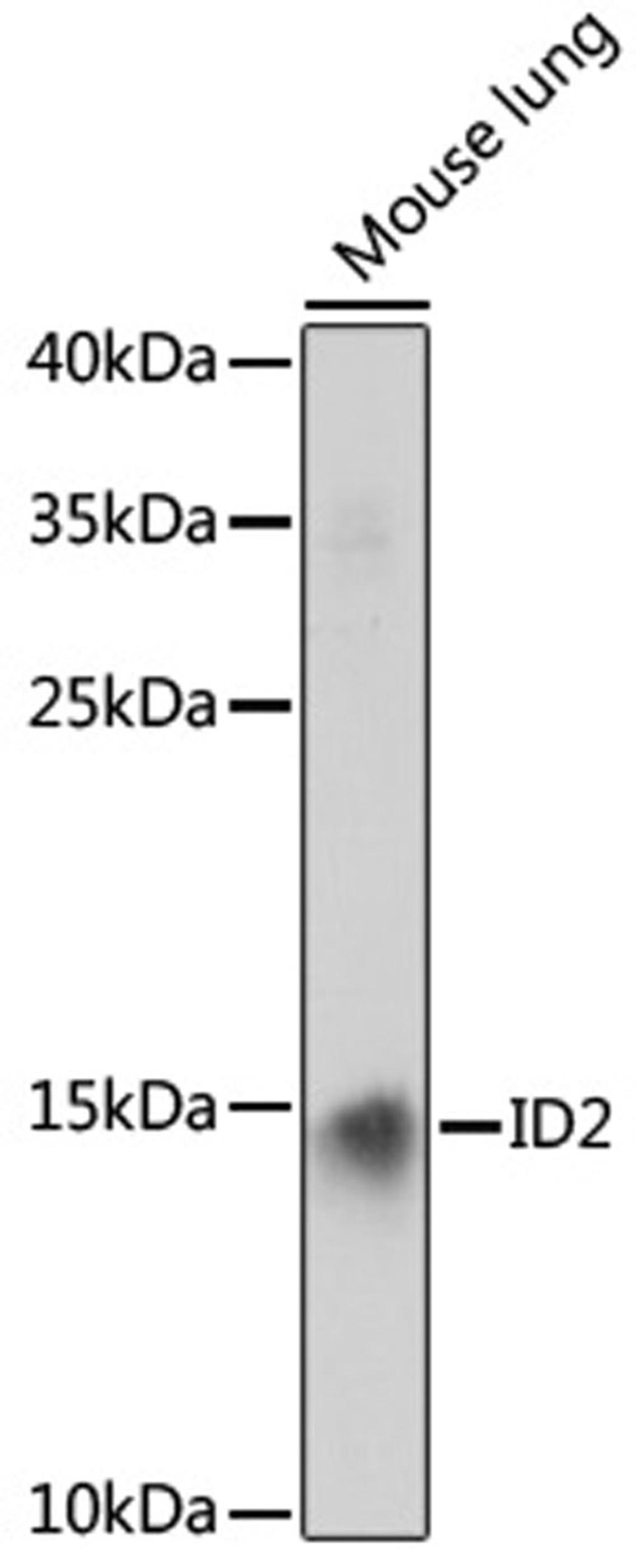 Western blot - ID2 antibody (A0996)