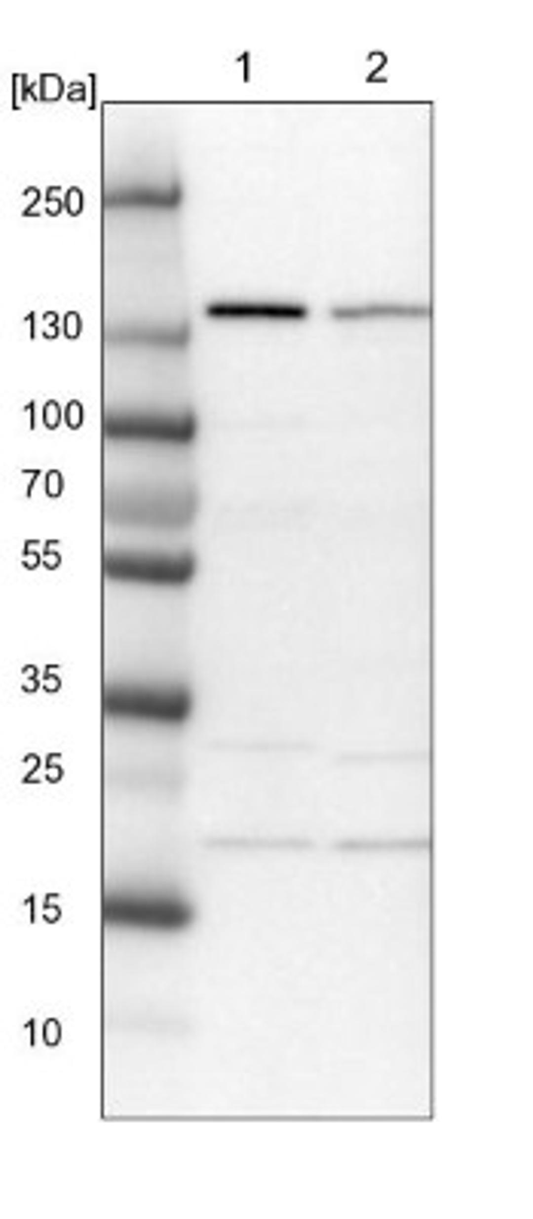 Western Blot: SCC112 Antibody [NBP1-87904] - Lane 1: NIH-3T3 cell lysate (Mouse embryonic fibroblast cells)<br/>Lane 2: NBT-II cell lysate (Rat Wistar bladder tumour cells)