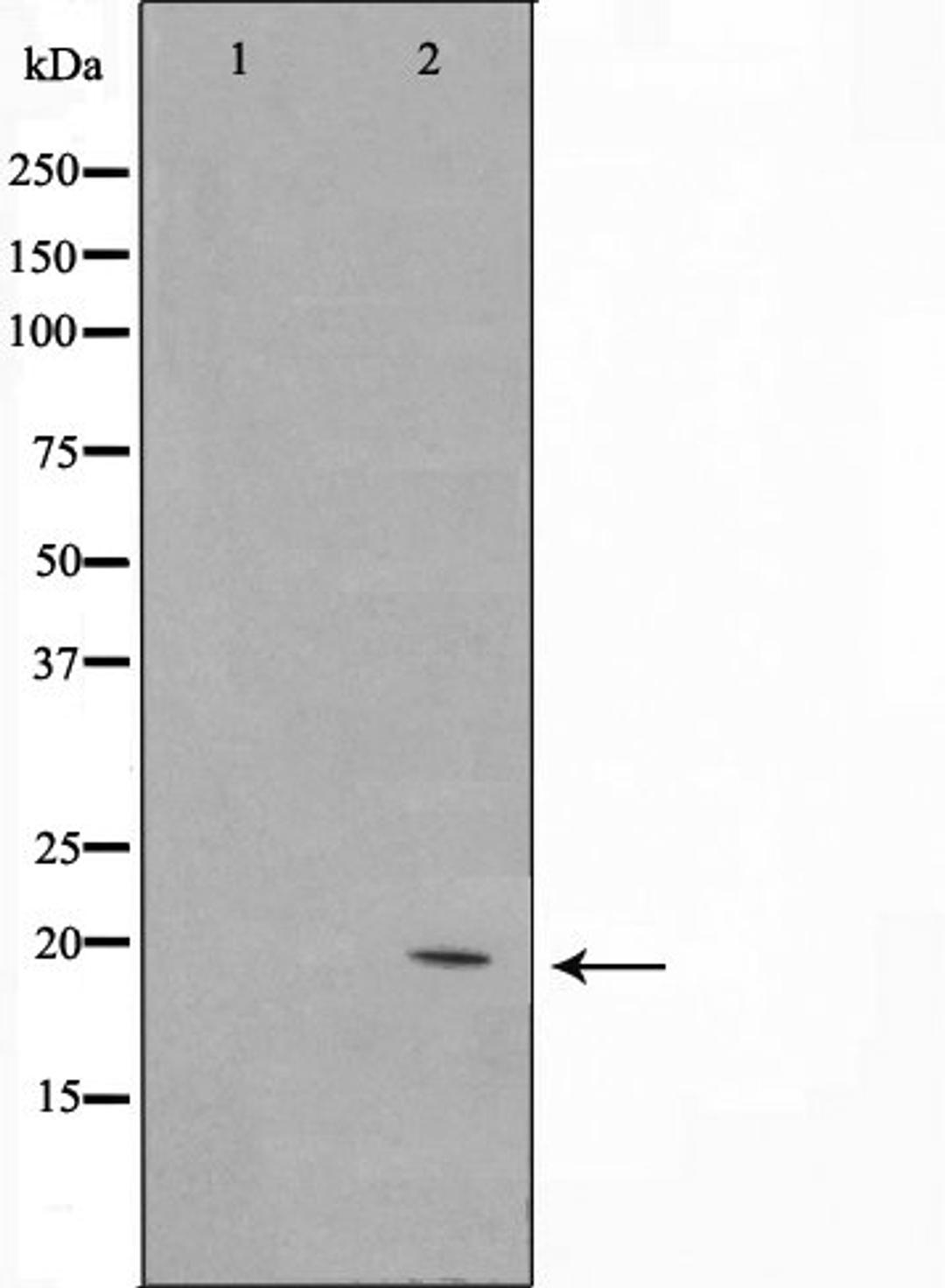 Western blot analysis of Jurkat cell lysate using C1orf57 antibody