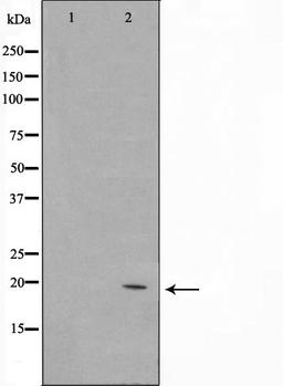 Western blot analysis of Jurkat cell lysate using C1orf57 antibody