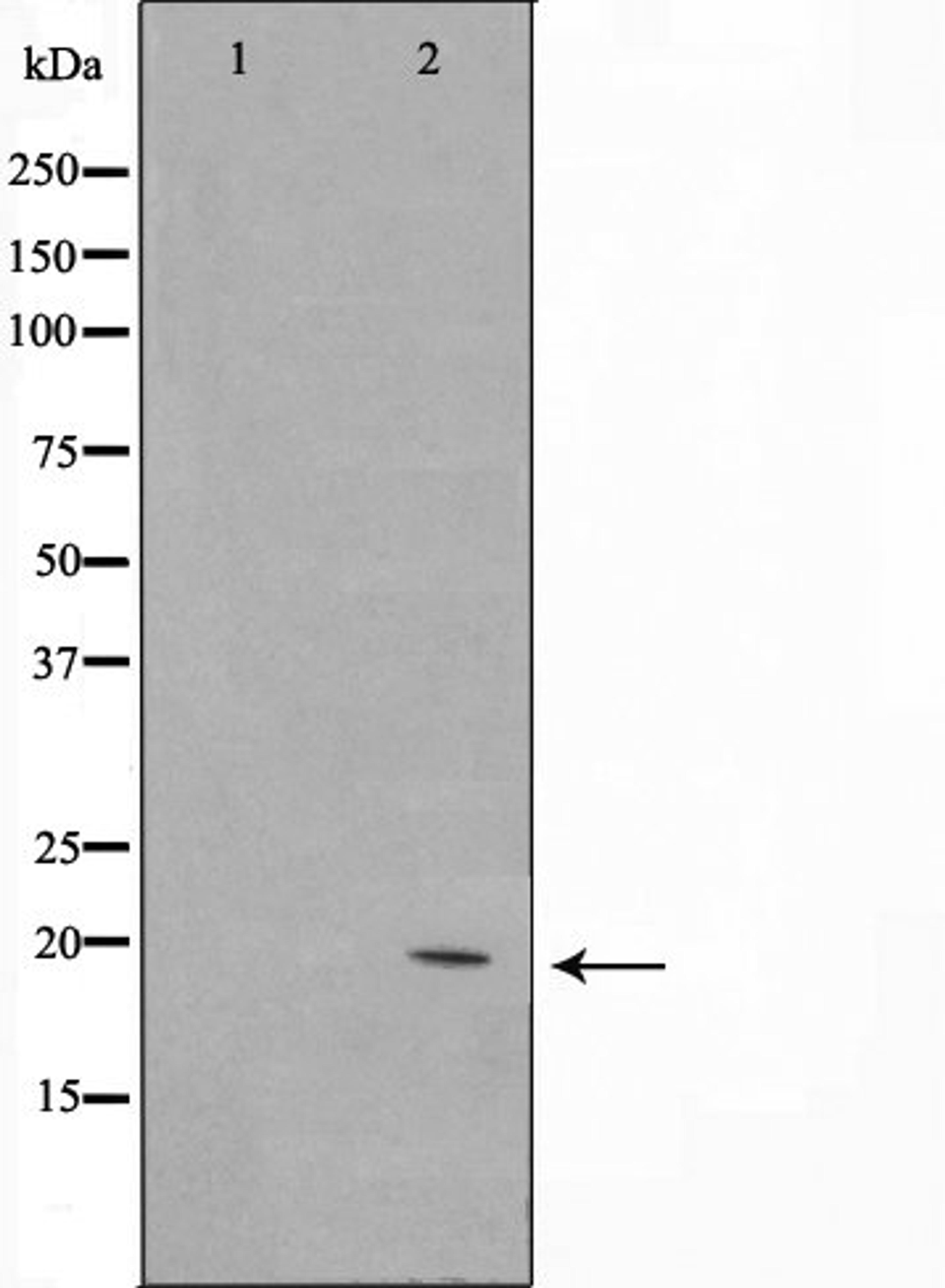 Western blot analysis of Jurkat cell lysate using C1orf57 antibody