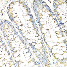 Immunohistochemistry - SERPINE1 antibody (A14758)
