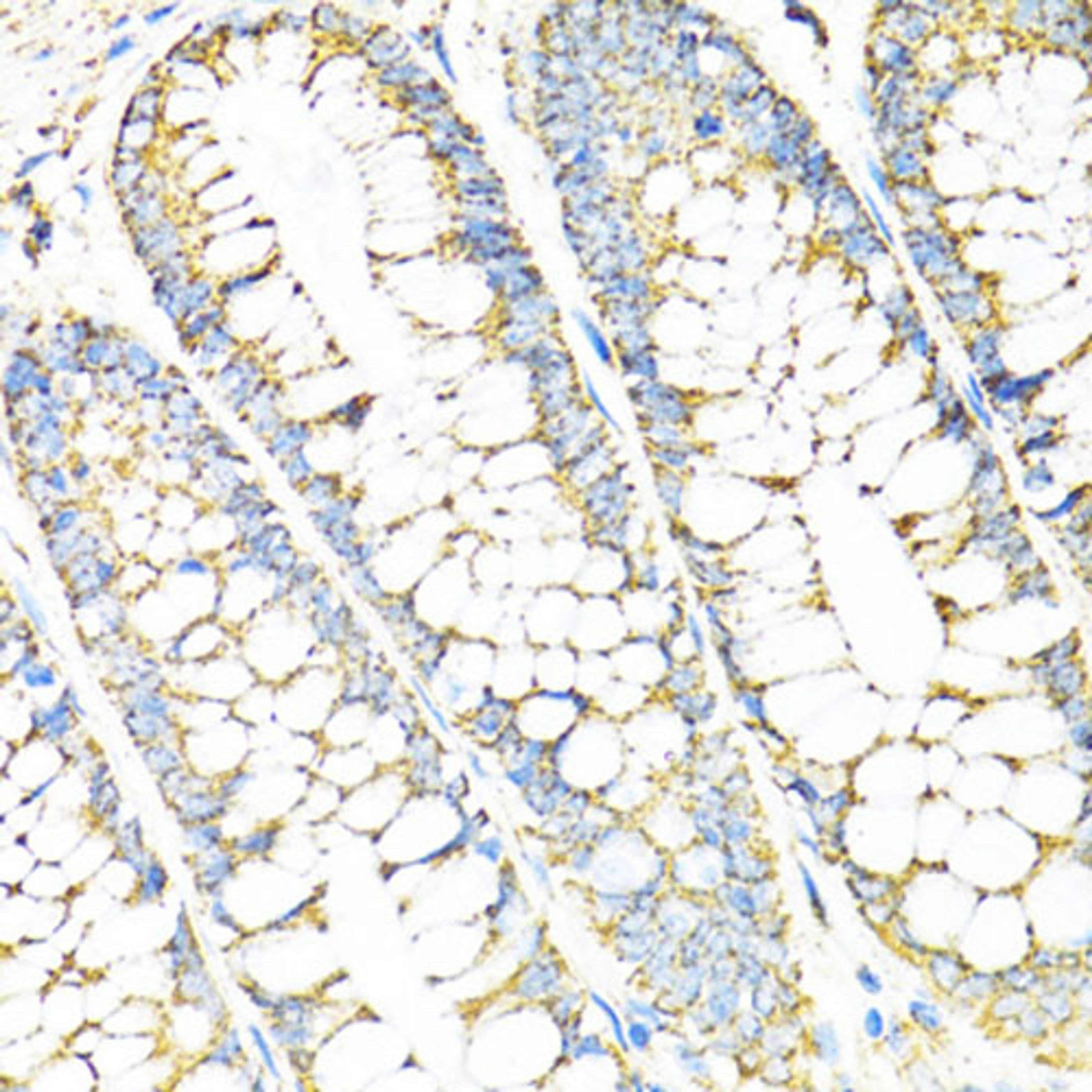 Immunohistochemistry - SERPINE1 antibody (A14758)