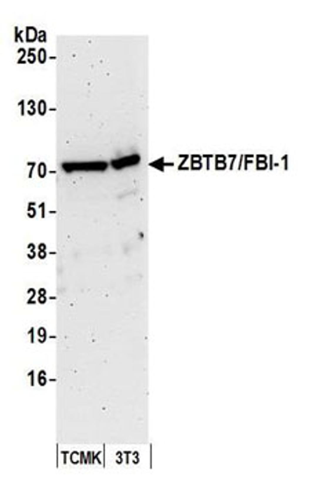 Detection of mouse ZBTB7/FBI-1 by western blot.