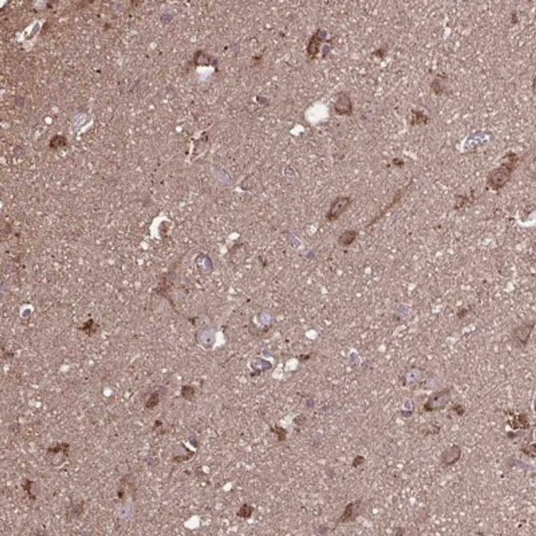 Immunohistochemistry: ACOT6 Antibody [NBP2-31708] - Staining of human cerebral cortex shows cytoplasmic and nucleolar positivity in neuronal cells.