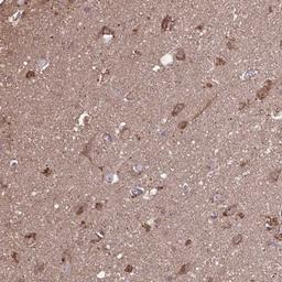 Immunohistochemistry: ACOT6 Antibody [NBP2-31708] - Staining of human cerebral cortex shows cytoplasmic and nucleolar positivity in neuronal cells.