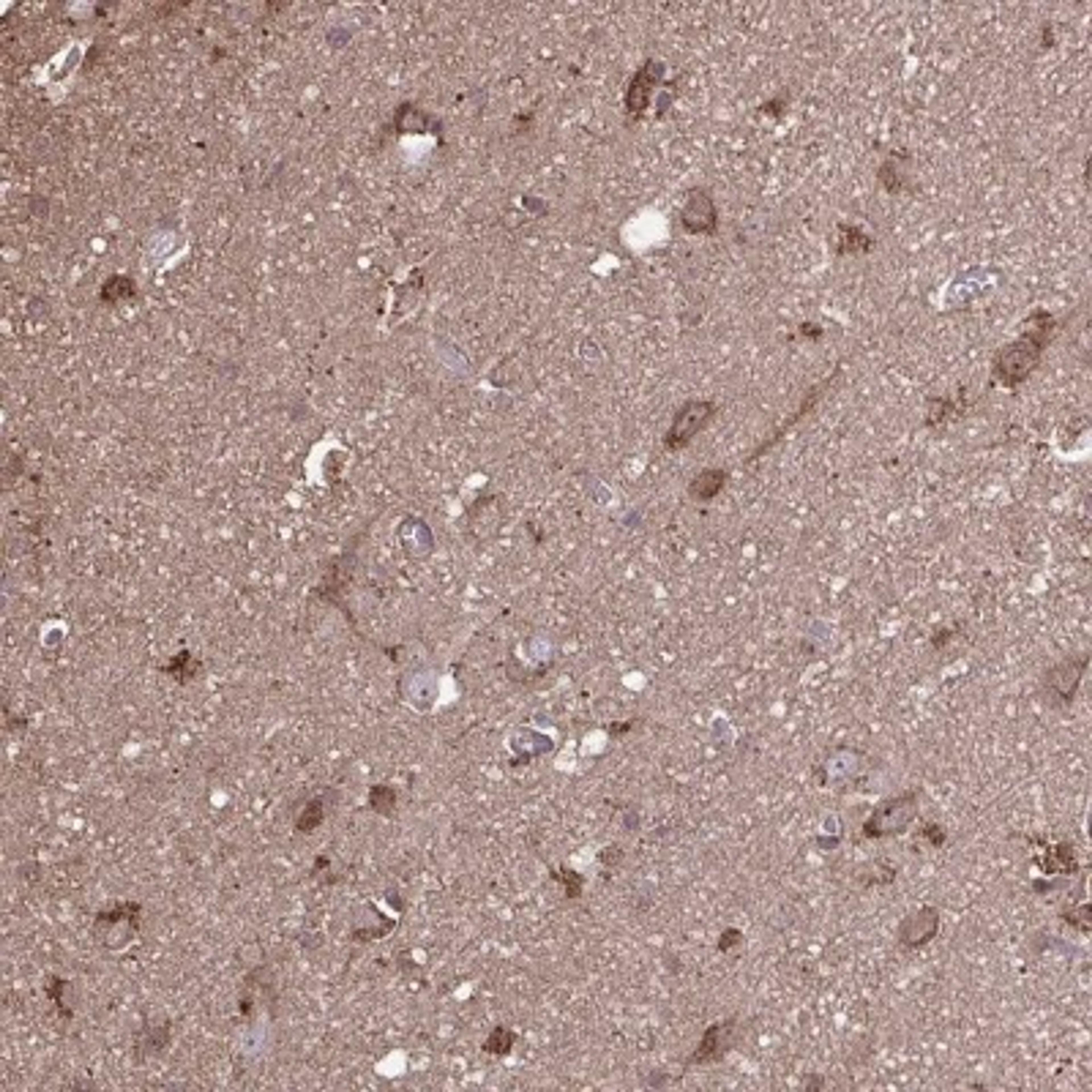 Immunohistochemistry: ACOT6 Antibody [NBP2-31708] - Staining of human cerebral cortex shows cytoplasmic and nucleolar positivity in neuronal cells.