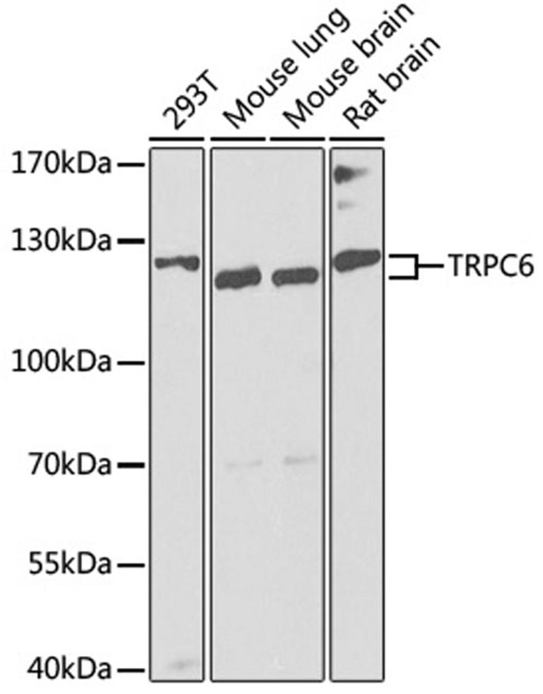 Western blot - TRPC6 antibody (A8155)