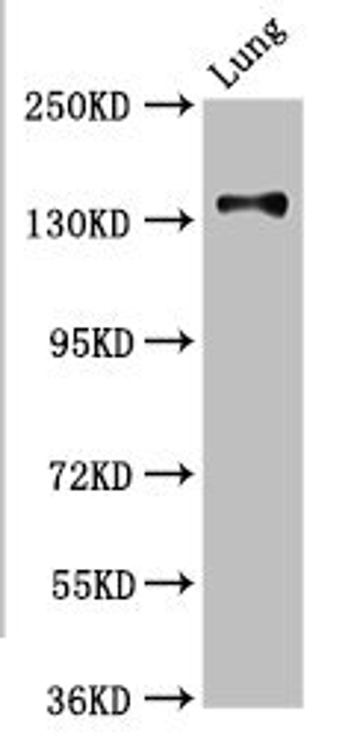 Western Blot. Positive WB detected in: Rat kidney tissue. All lanes: MAN2B2 antibody at 3.4ug/ml. Secondary. Goat polyclonal to rabbit IgG at 1/50000 dilution. Predicted band size: 114, 108 kDa. Observed band size: 114 kDa. 