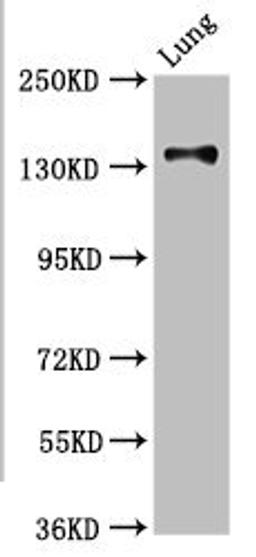 Western Blot. Positive WB detected in: Rat kidney tissue. All lanes: MAN2B2 antibody at 3.4ug/ml. Secondary. Goat polyclonal to rabbit IgG at 1/50000 dilution. Predicted band size: 114, 108 kDa. Observed band size: 114 kDa. 