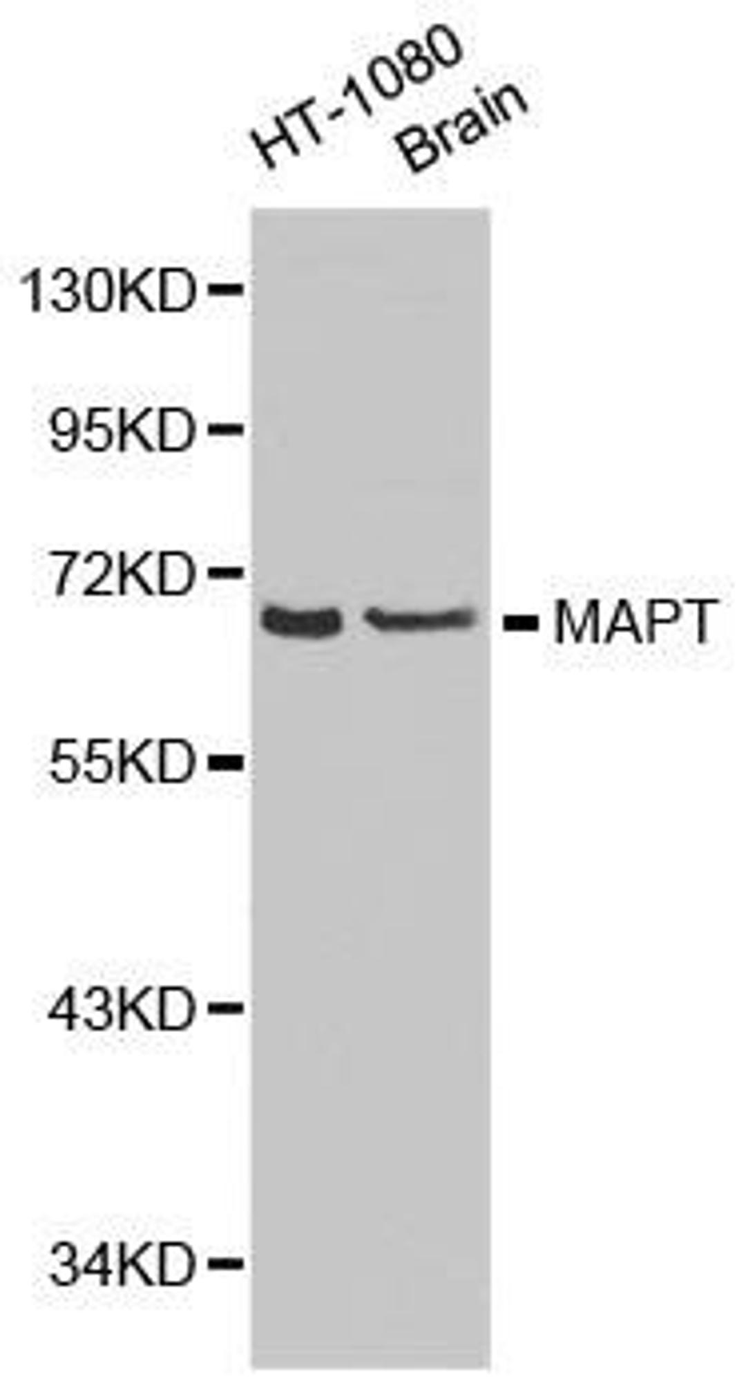 Western blot analysis of extracts of HT-1080 cell and brain cell line using MAPT antibody