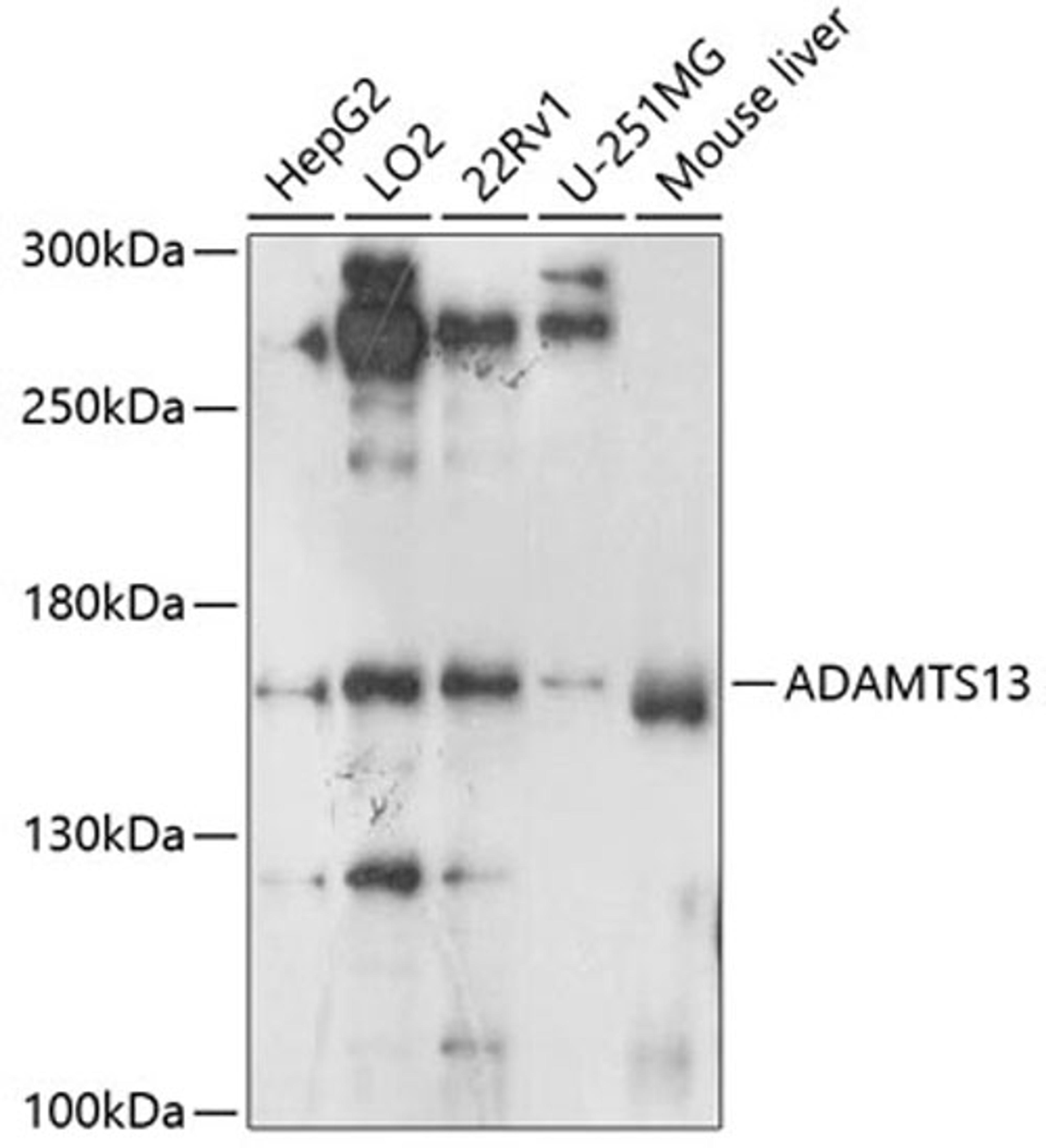 Western blot - ADAMTS13 antibody (A8482)