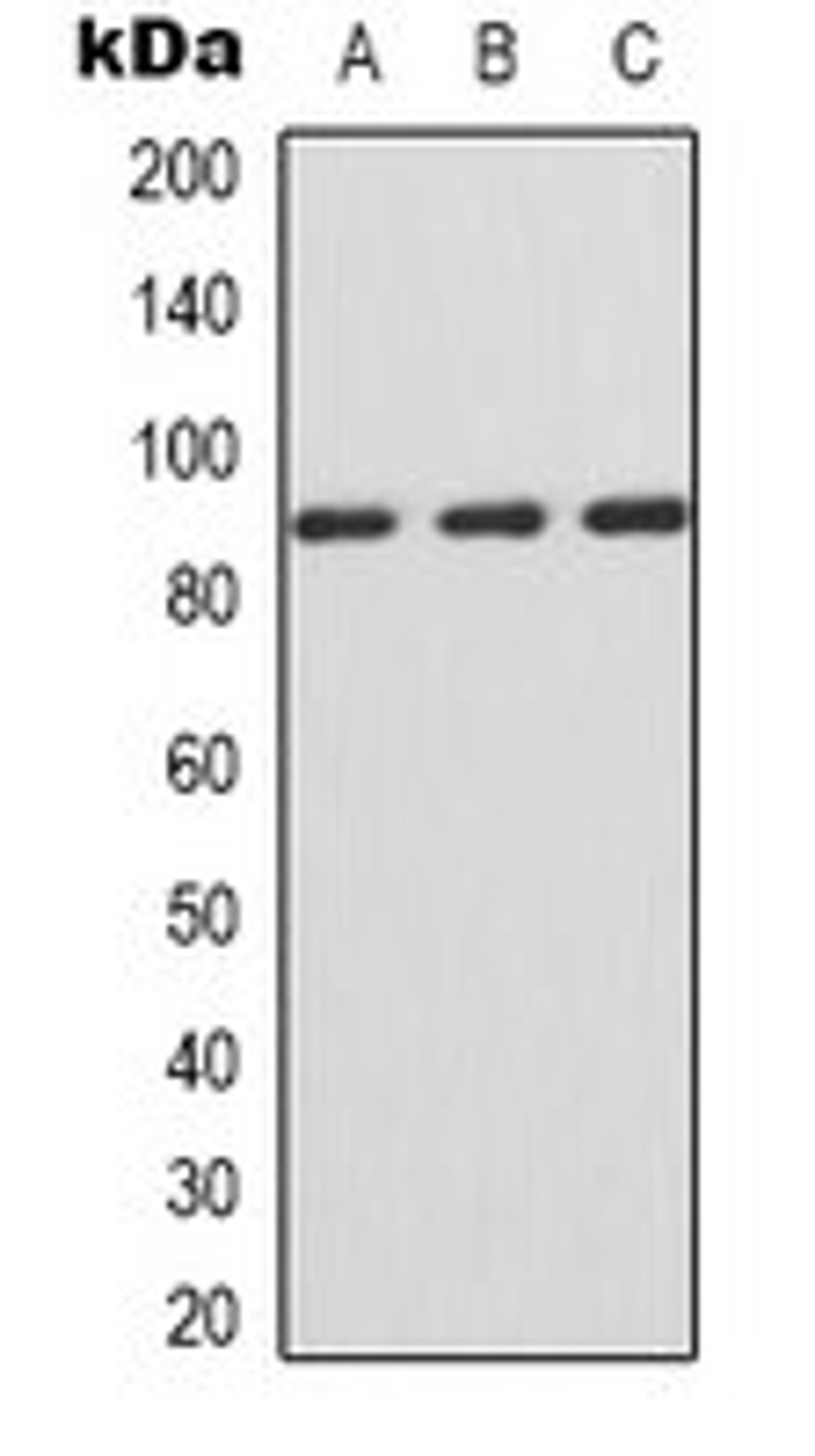 Western blot analysis of Jurkat (Lane 1), HepG2 (Lane 2), COS7 (Lane 3) whole cell lysates using IFNGR1 antibody