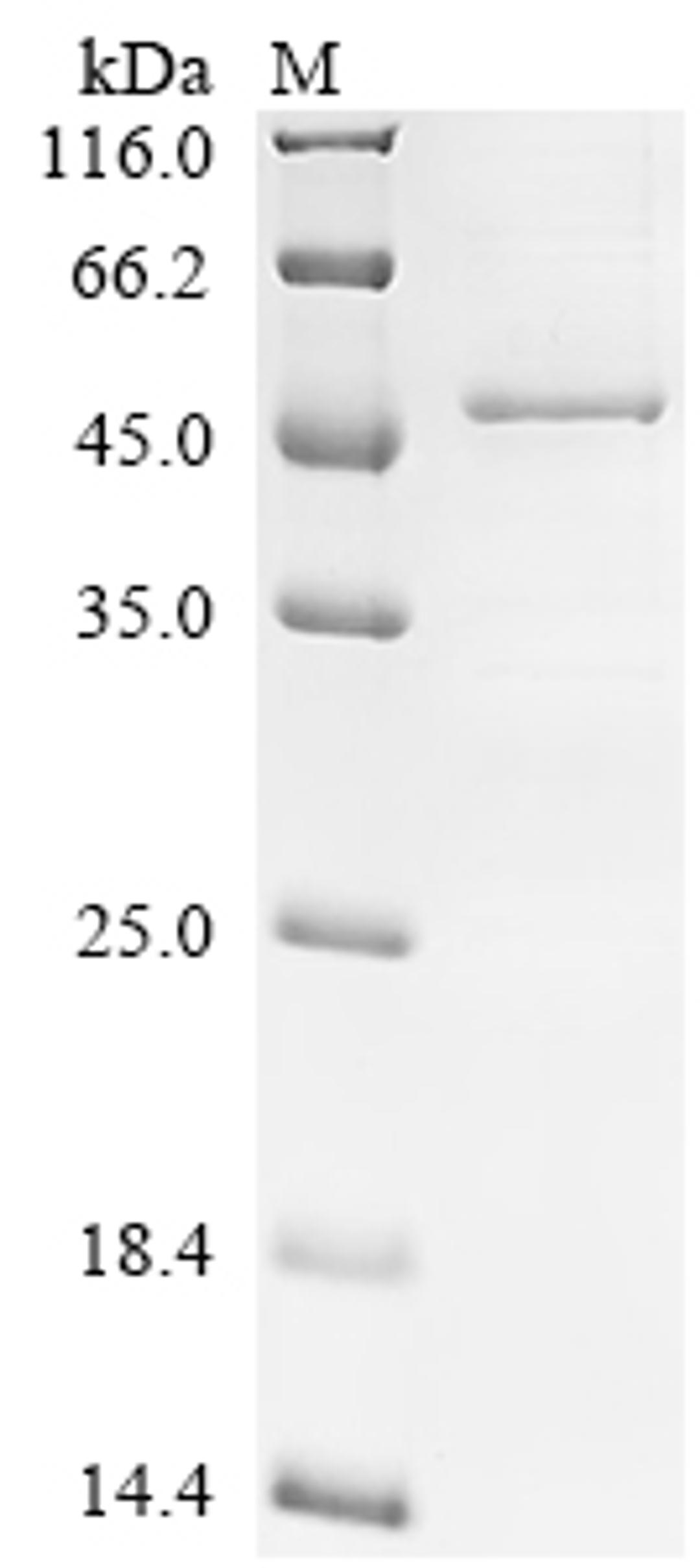 (Tris-Glycine gel) Discontinuous SDS-PAGE (reduced) with 5% enrichment gel and 15% separation gel.