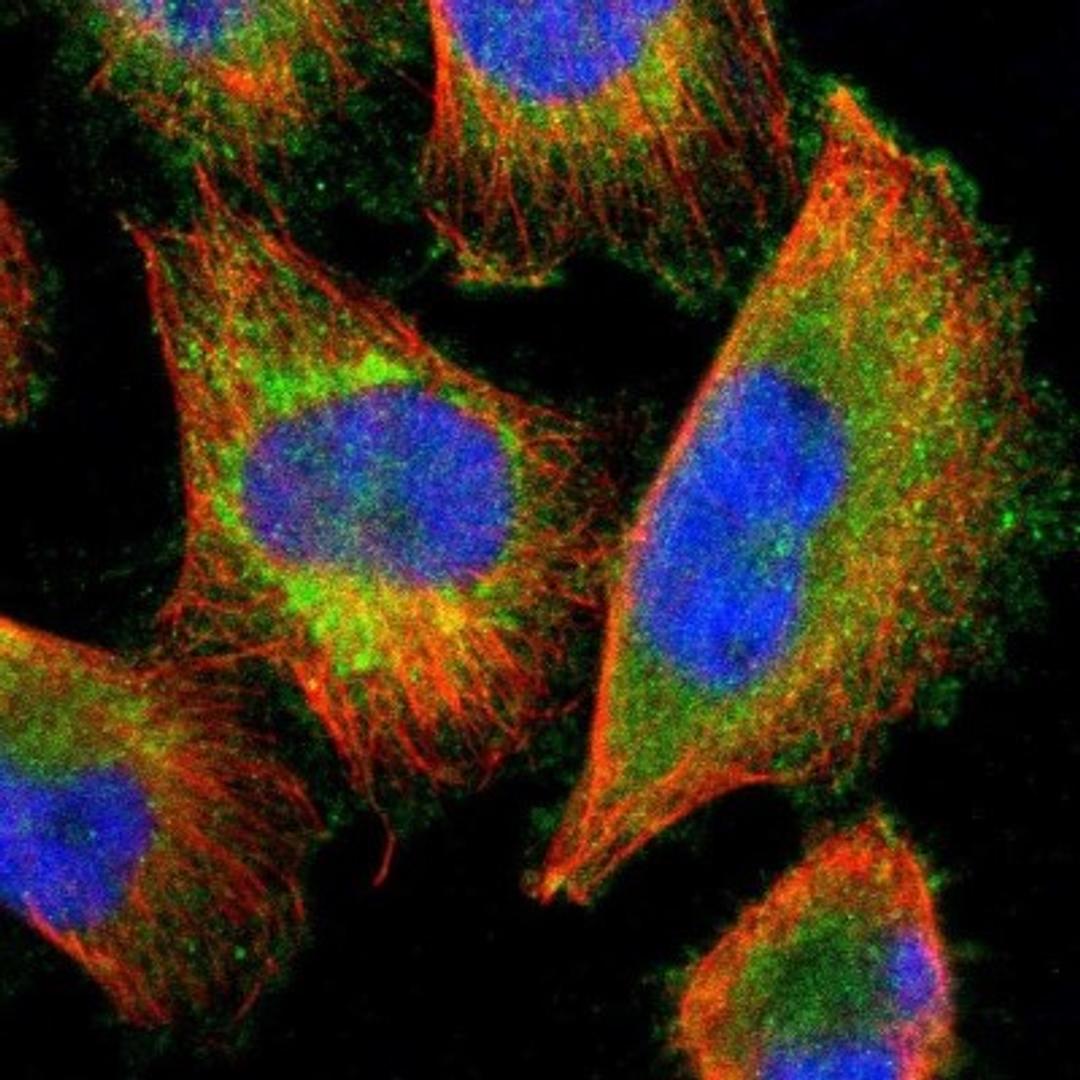 Immunocytochemistry/Immunofluorescence: OSBPL10 Antibody [NBP1-86153] - Staining of human cell line U-251MG shows positivity in plasma membrane, cytoplasm & golgi apparatus.