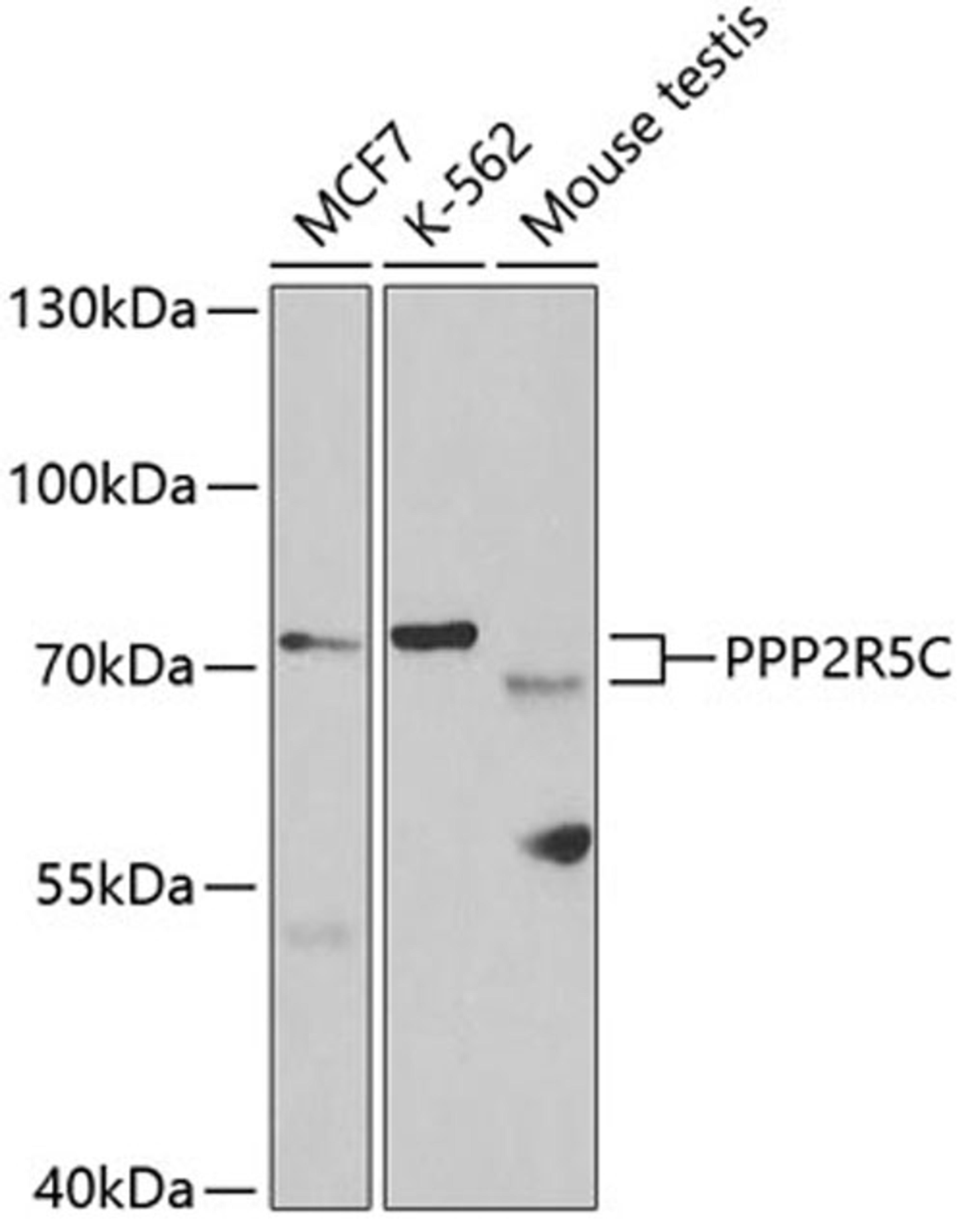 Western blot - PPP2R5C antibody (A5480)