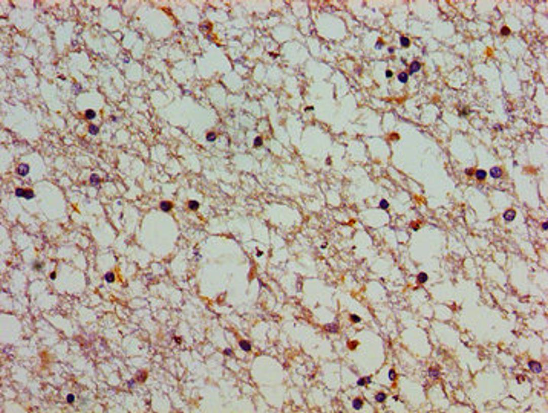 Immunohistochemistry of paraffin-embedded human brain tissue using CSB-PA002339LA01HU at dilution of 1:100