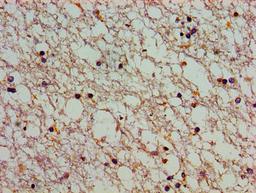 Immunohistochemistry of paraffin-embedded human brain tissue using CSB-PA002339LA01HU at dilution of 1:100