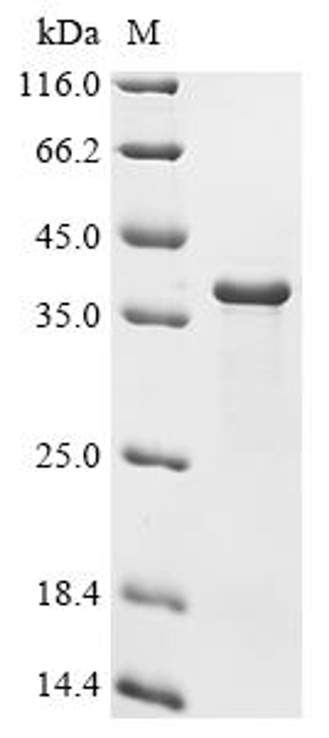 (Tris-Glycine gel) Discontinuous SDS-PAGE (reduced) with 5% enrichment gel and 15% separation gel.