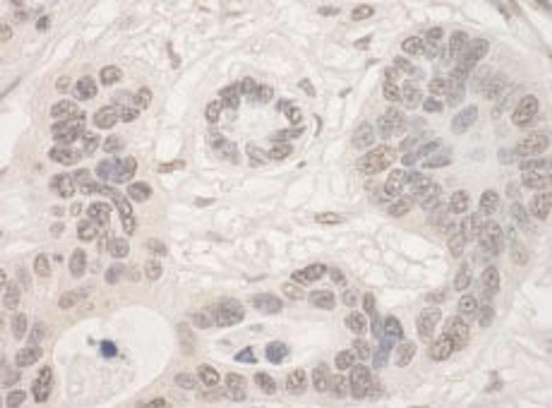 Detection of human THOC2 by immunohistochemistry.