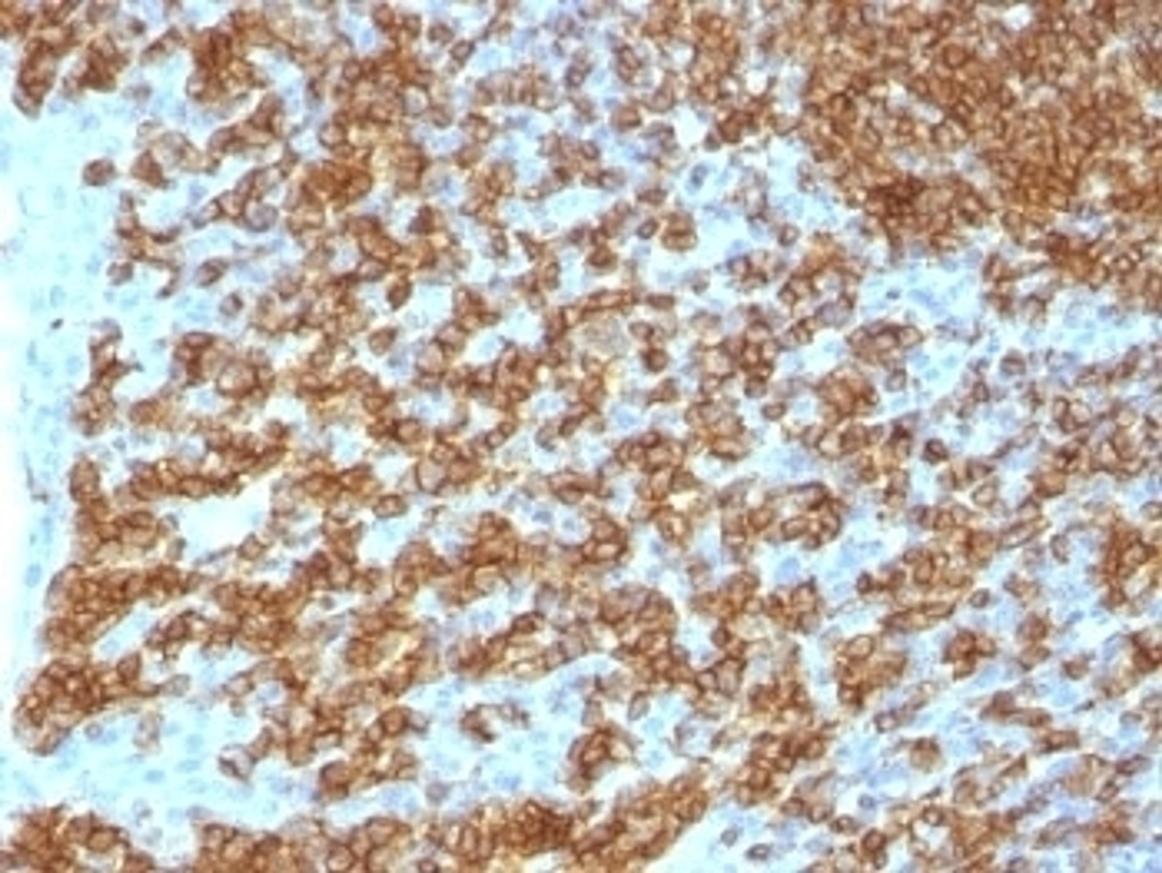 IHC test of FFPE human tonsil probed with CD45RA antibody