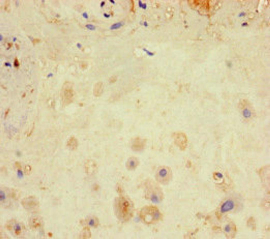 Immunohistochemistry of paraffin-embedded human placenta tissue using CSB-PA012769LA01HU at dilution of 1:100
