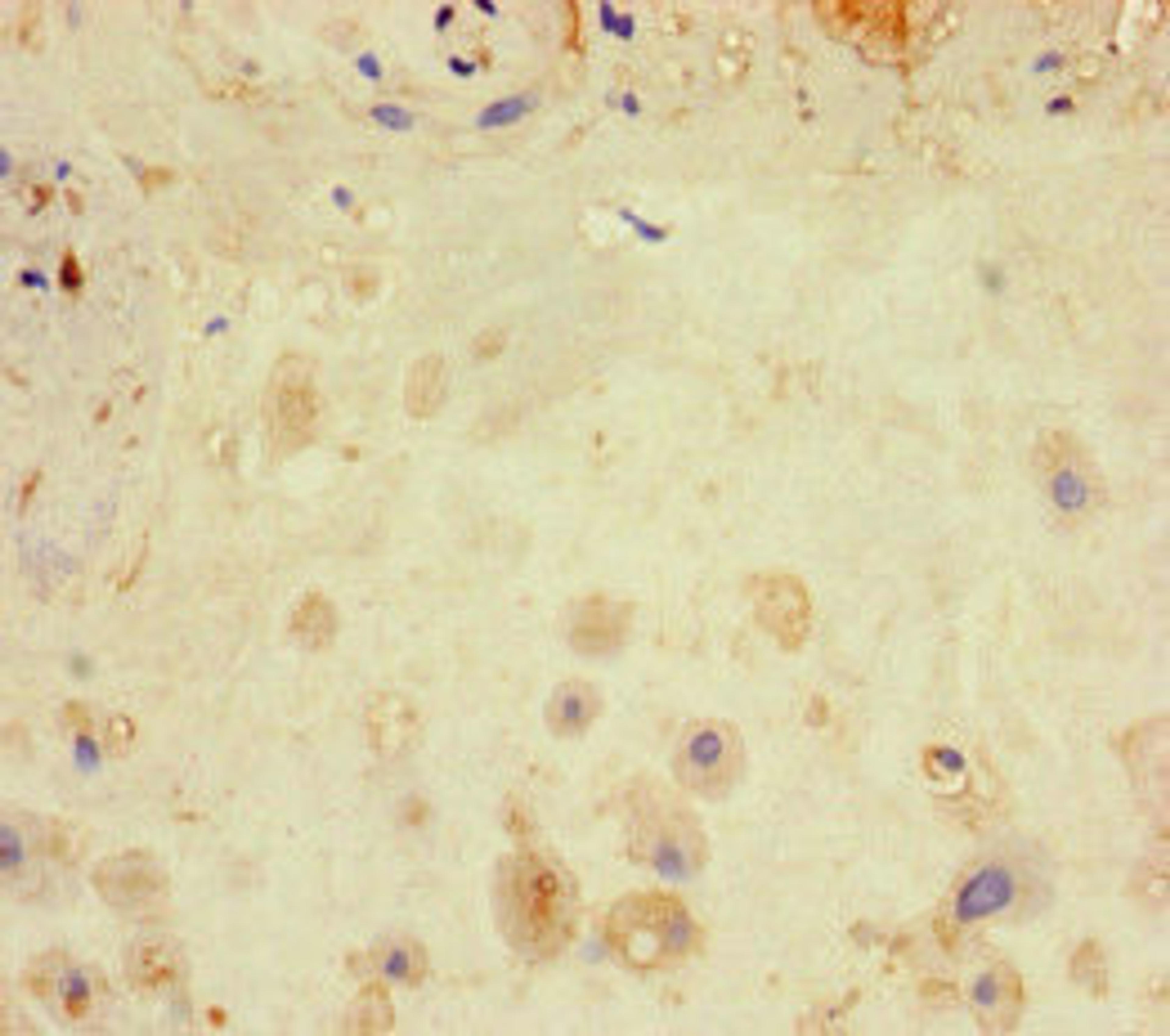 Immunohistochemistry of paraffin-embedded human placenta tissue using CSB-PA012769LA01HU at dilution of 1:100
