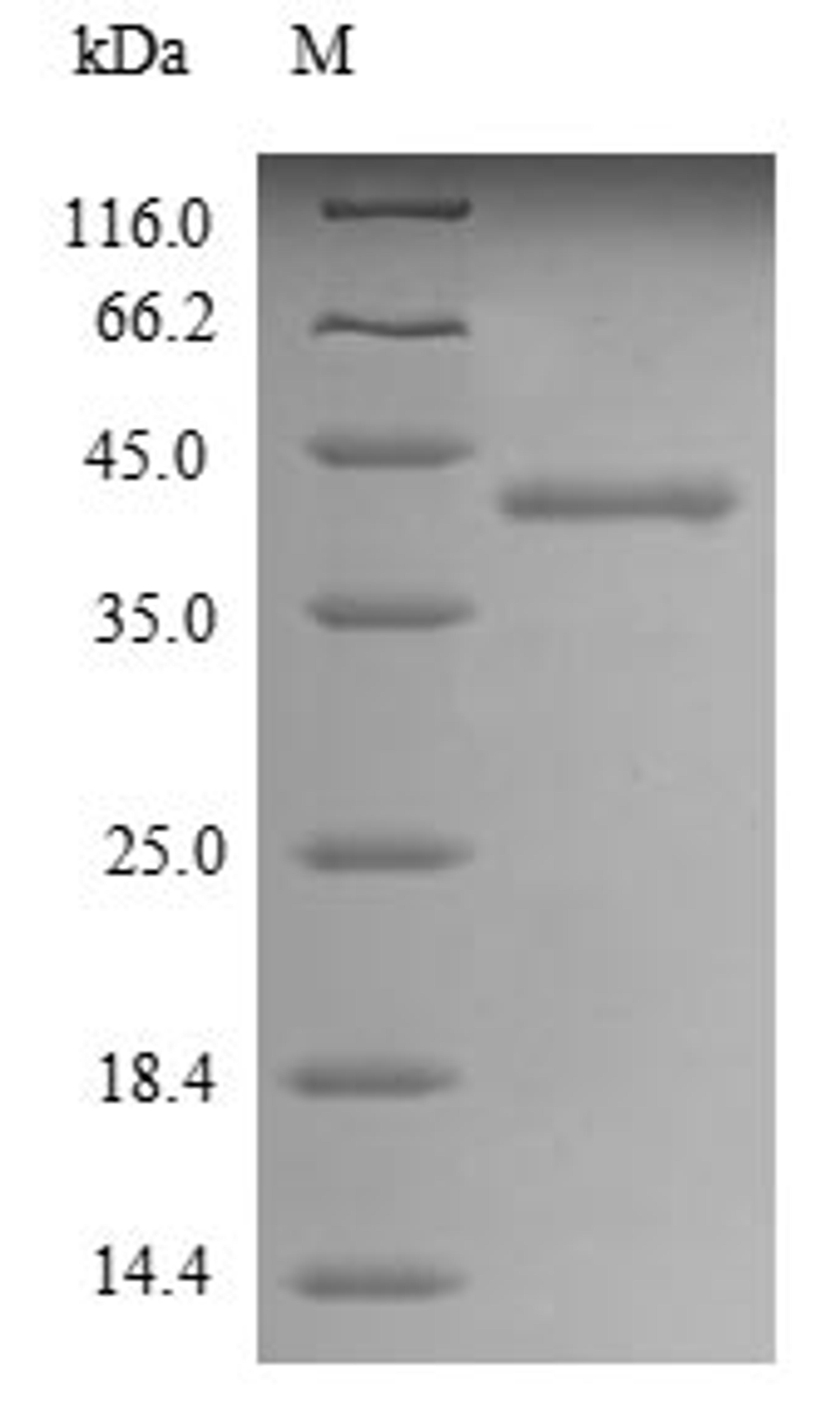 (Tris-Glycine gel) Discontinuous SDS-PAGE (reduced) with 5% enrichment gel and 15% separation gel.