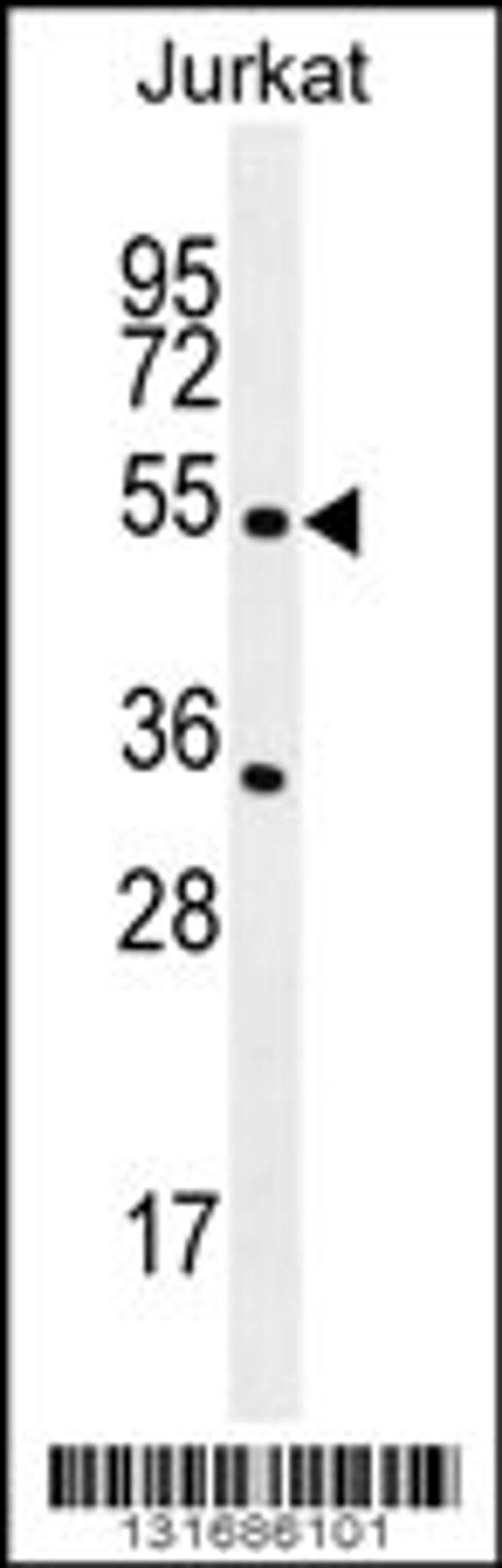 Western blot analysis in Jurkat cell line lysates (35ug/lane).