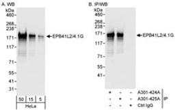 Detection of human EPB41L2/4.1G by western blot and immunoprecipitation.