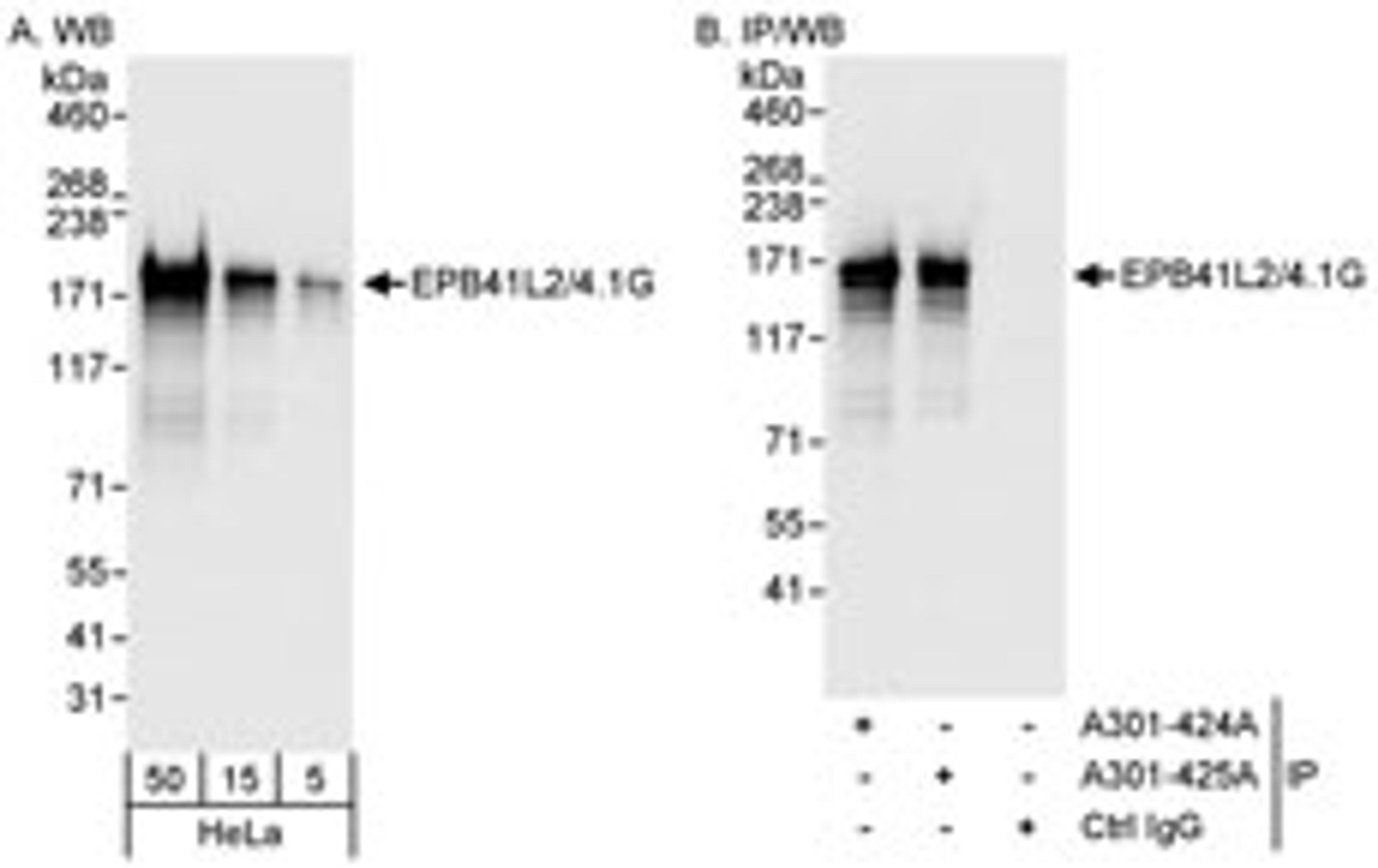 Detection of human EPB41L2/4.1G by western blot and immunoprecipitation.