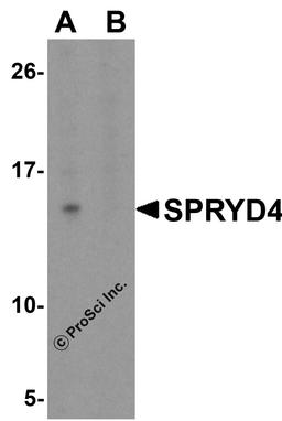 Western blot analysis of SPRYD4 in fetal human liver tissue lysate with SPRYD4 antibody at 1 μg/mL in (A) the absence and (B) the presence of blocking peptide