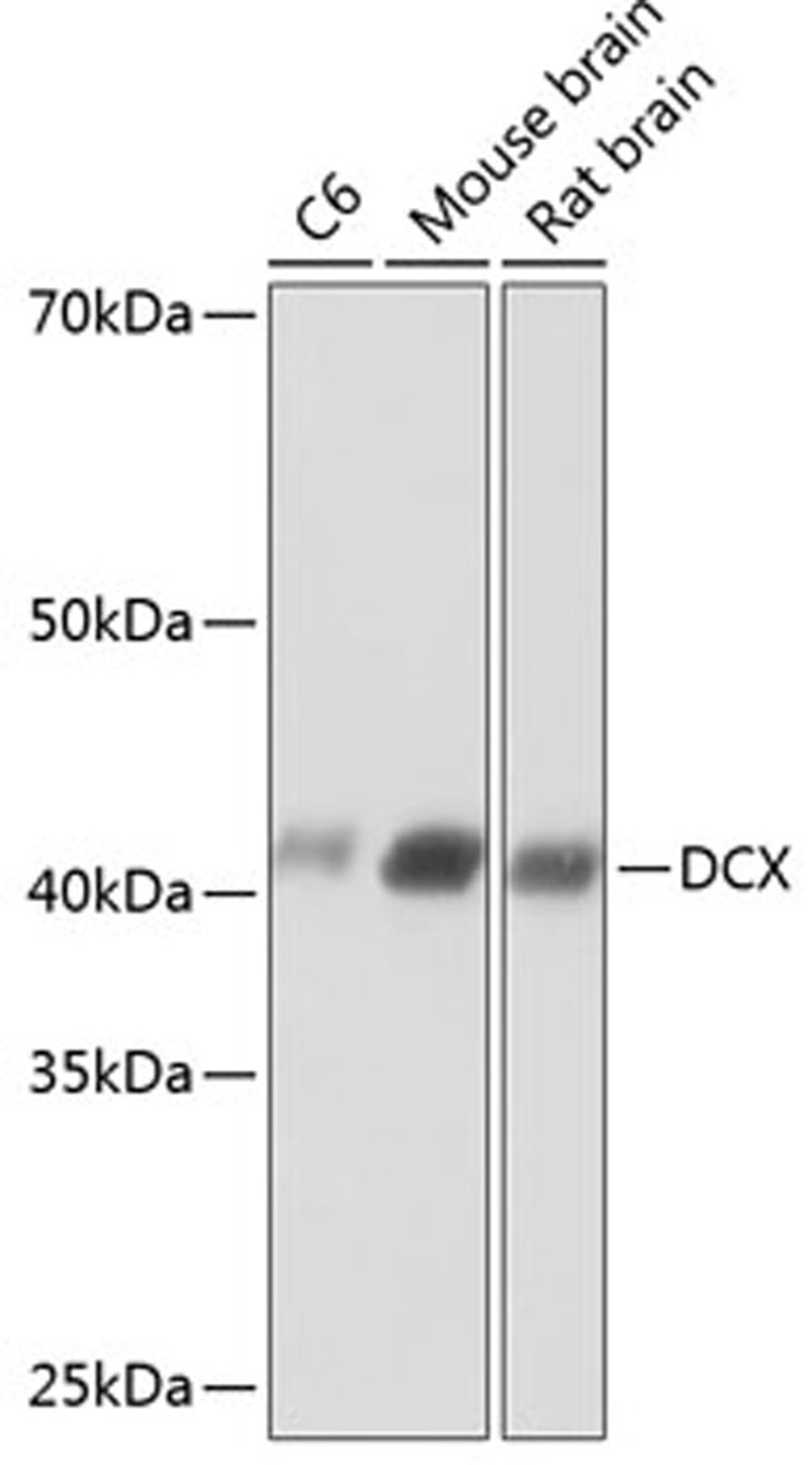 Western blot - DCX antibody (A19042)