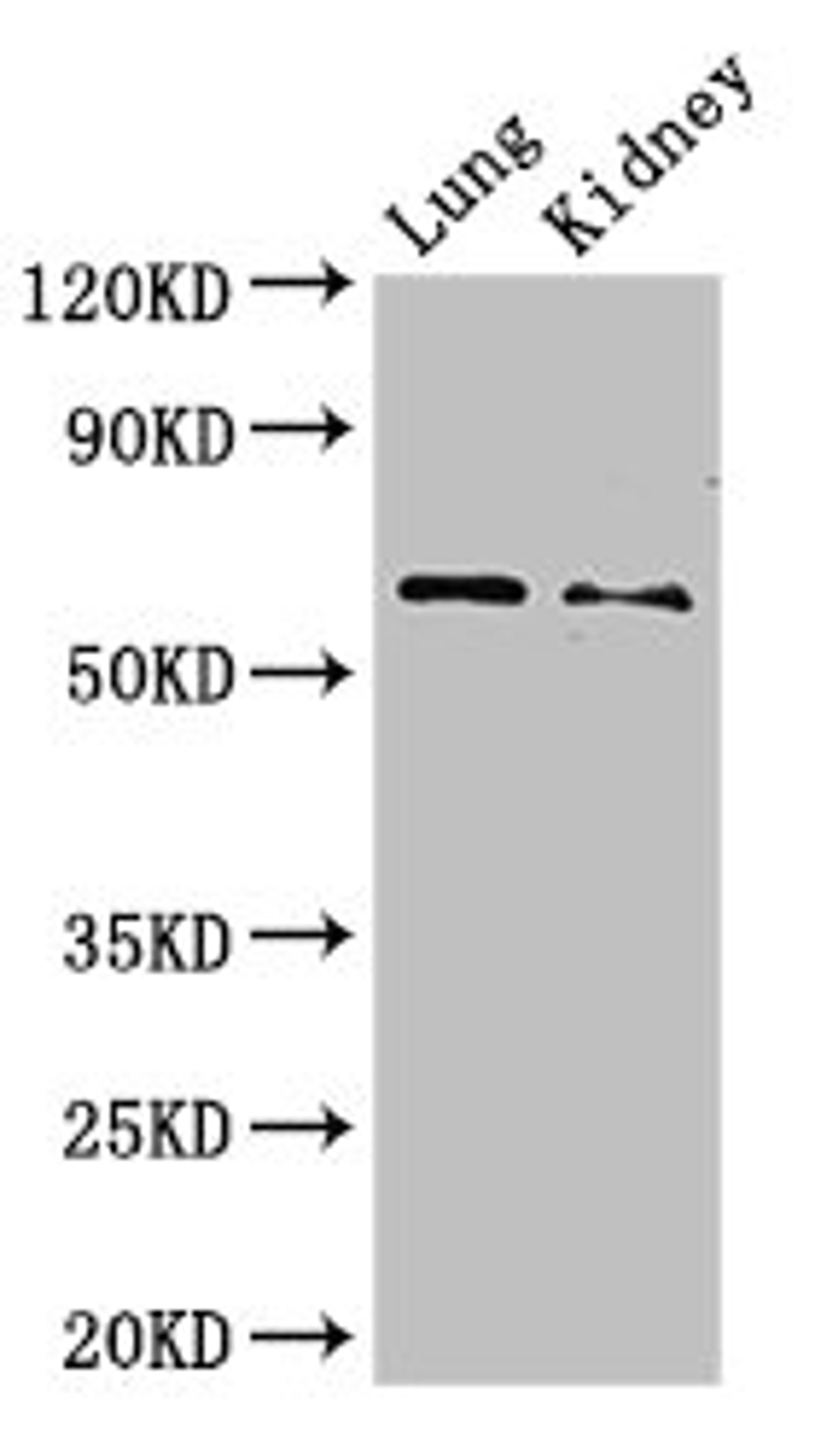 Western Blot. Positive WB detected in: Mouse lung tissue, Mouse kidney tissue. All lanes: Plbd2 antibody at 3ug/ml. Secondary. Goat polyclonal to rabbit IgG at 1/50000 dilution. Predicted band size: 66 kDa. Observed band size: 66 kDa.