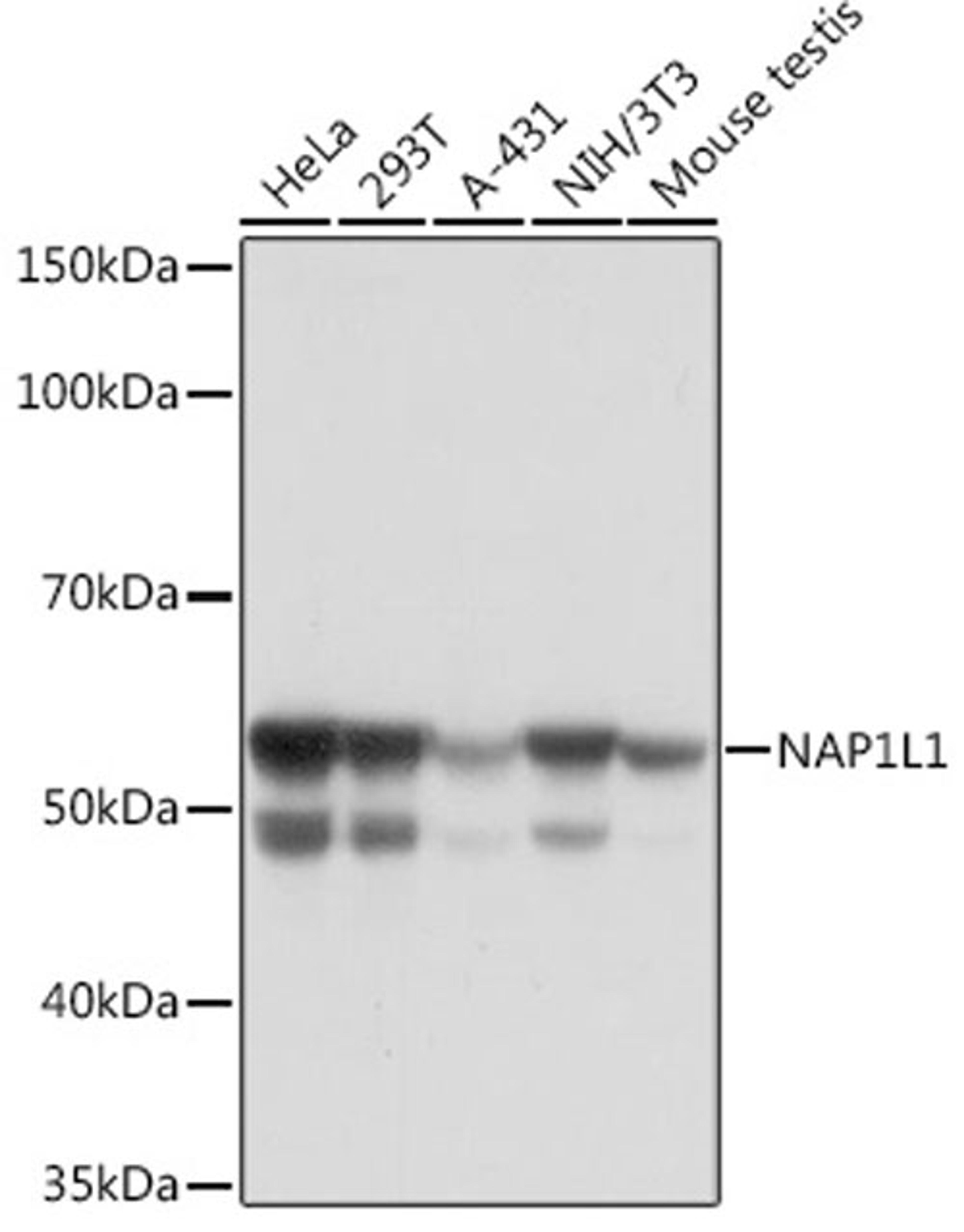 Western blot - NAP1L1 Rabbit mAb (A6174)