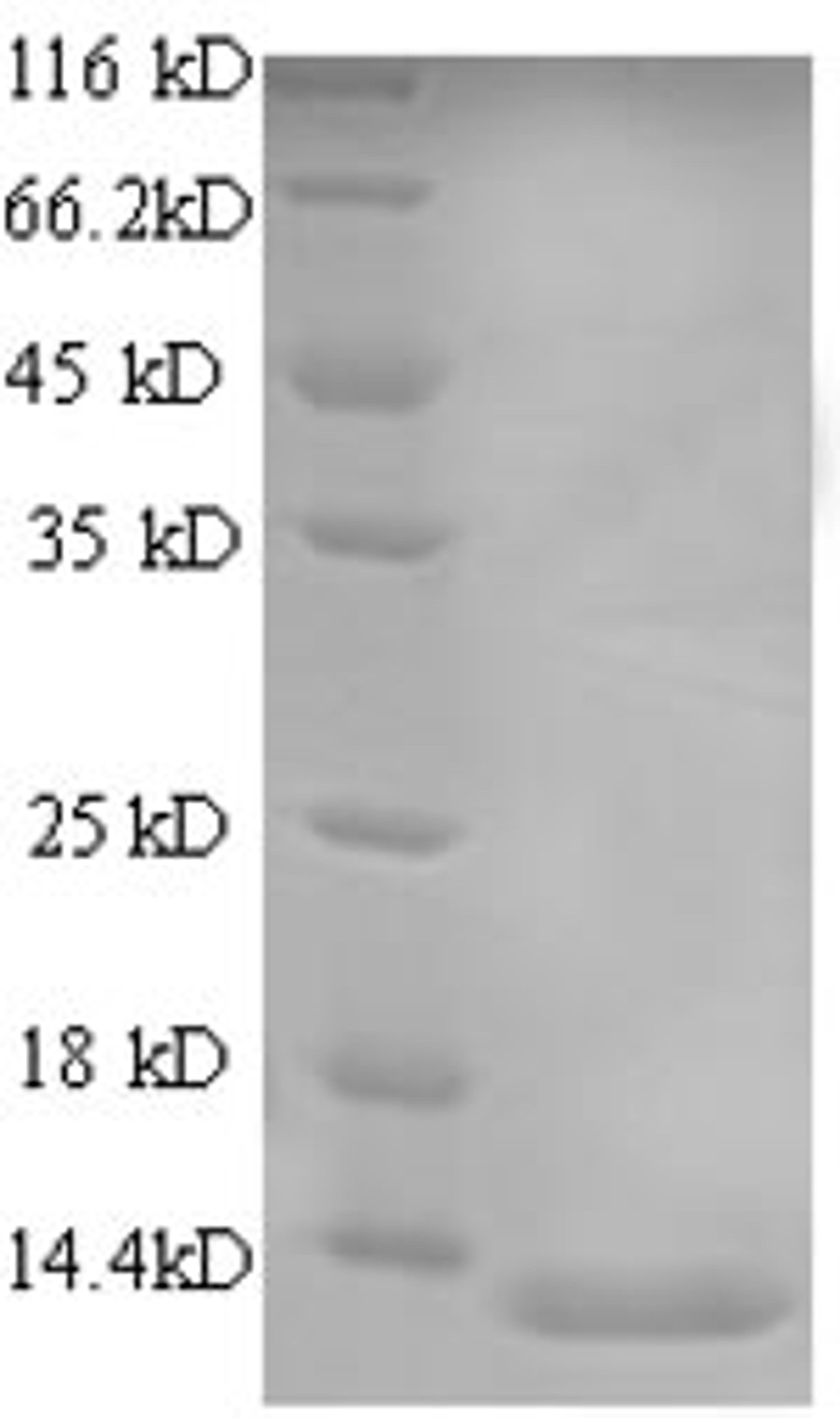(Tris-Glycine gel) Discontinuous SDS-PAGE (reduced) with 5% enrichment gel and 15% separation gel.