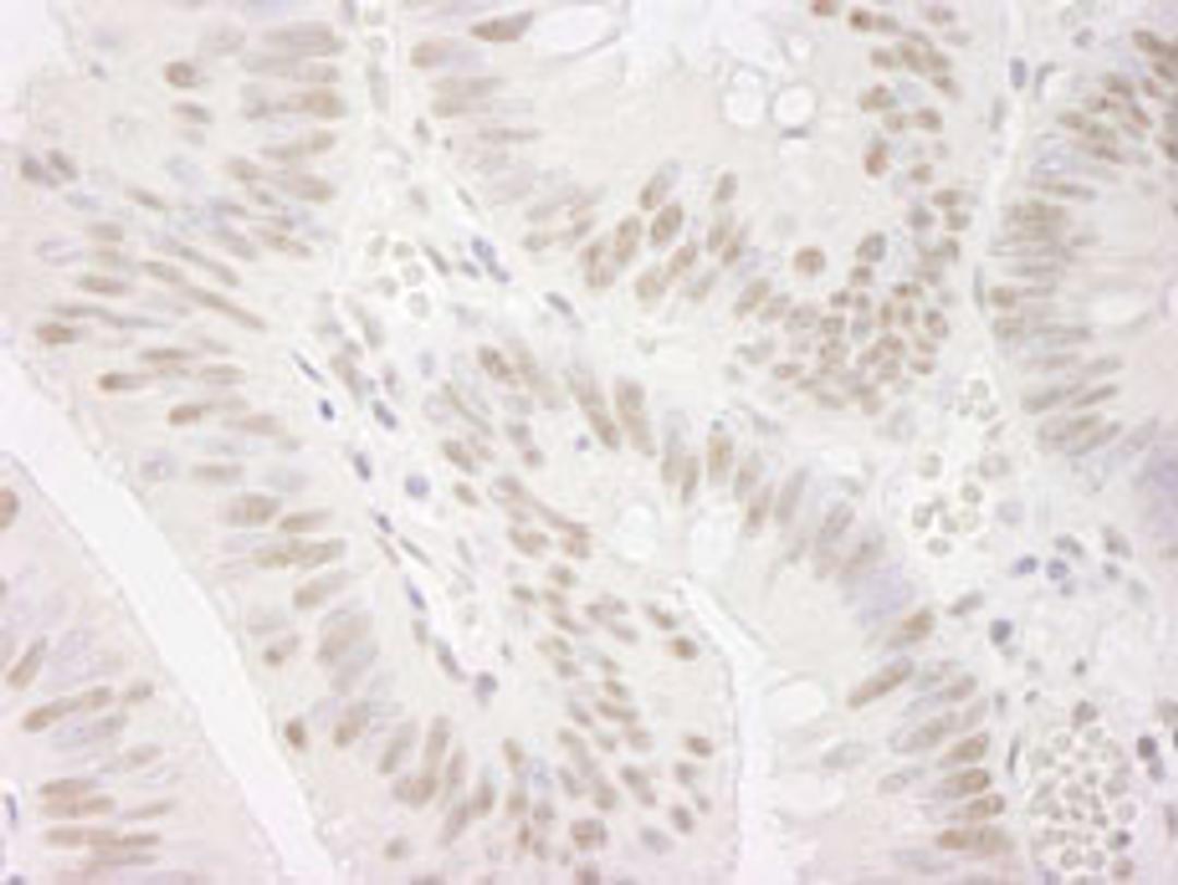 Detection of human PPP4R3 Alpha by immunohistochemistry.