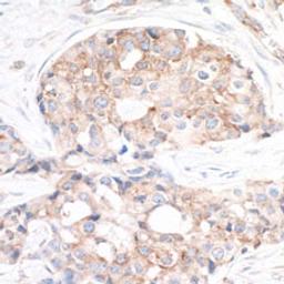 Detection of human RPS6 by immunohistochemistry.