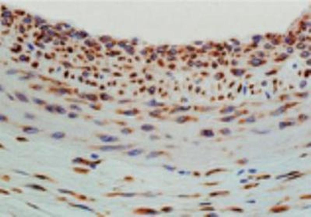 Immunohistochemistry-Paraffin: Hsp47 Antibody (M16.10A1) [NBP1-97491] - Analysis of paraffin-embedded tissue section of rat carotid artery 14 days after balloon-injury to the artery, stained using Hsp47 (Colligin) mAb (M16.10A1).