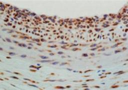 Immunohistochemistry-Paraffin: Hsp47 Antibody (M16.10A1) [NBP1-97491] - Analysis of paraffin-embedded tissue section of rat carotid artery 14 days after balloon-injury to the artery, stained using Hsp47 (Colligin) mAb (M16.10A1).