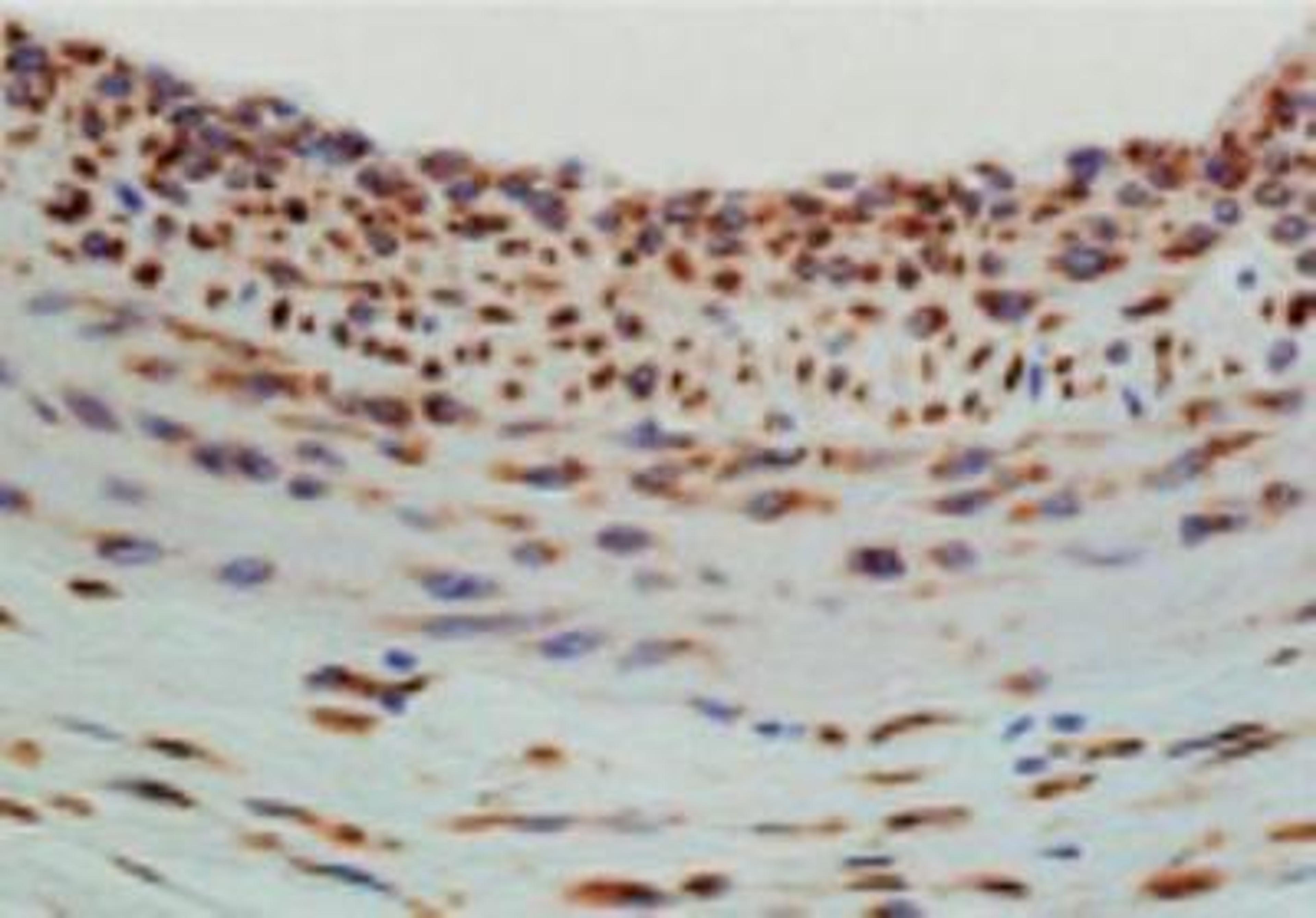 Immunohistochemistry-Paraffin: Hsp47 Antibody (M16.10A1) [NBP1-97491] - Analysis of paraffin-embedded tissue section of rat carotid artery 14 days after balloon-injury to the artery, stained using Hsp47 (Colligin) mAb (M16.10A1).