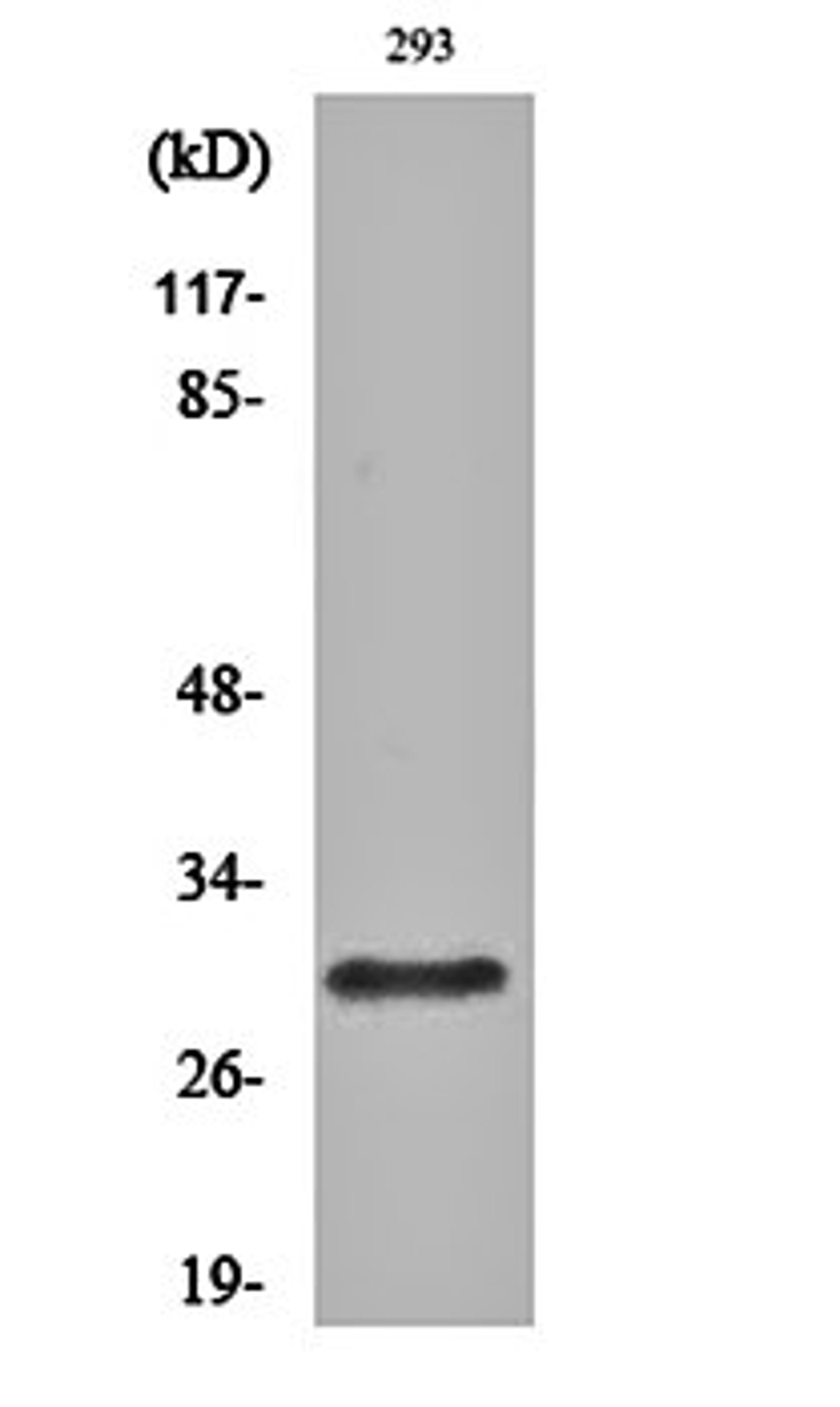 Western blot analysis of 293 cell lysates using Rab 34 antibody