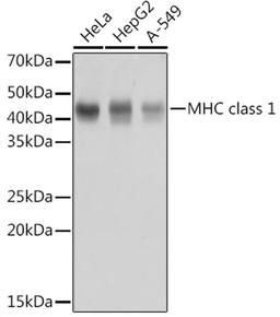 Western blot - MHC class 1 antibody (A11406)