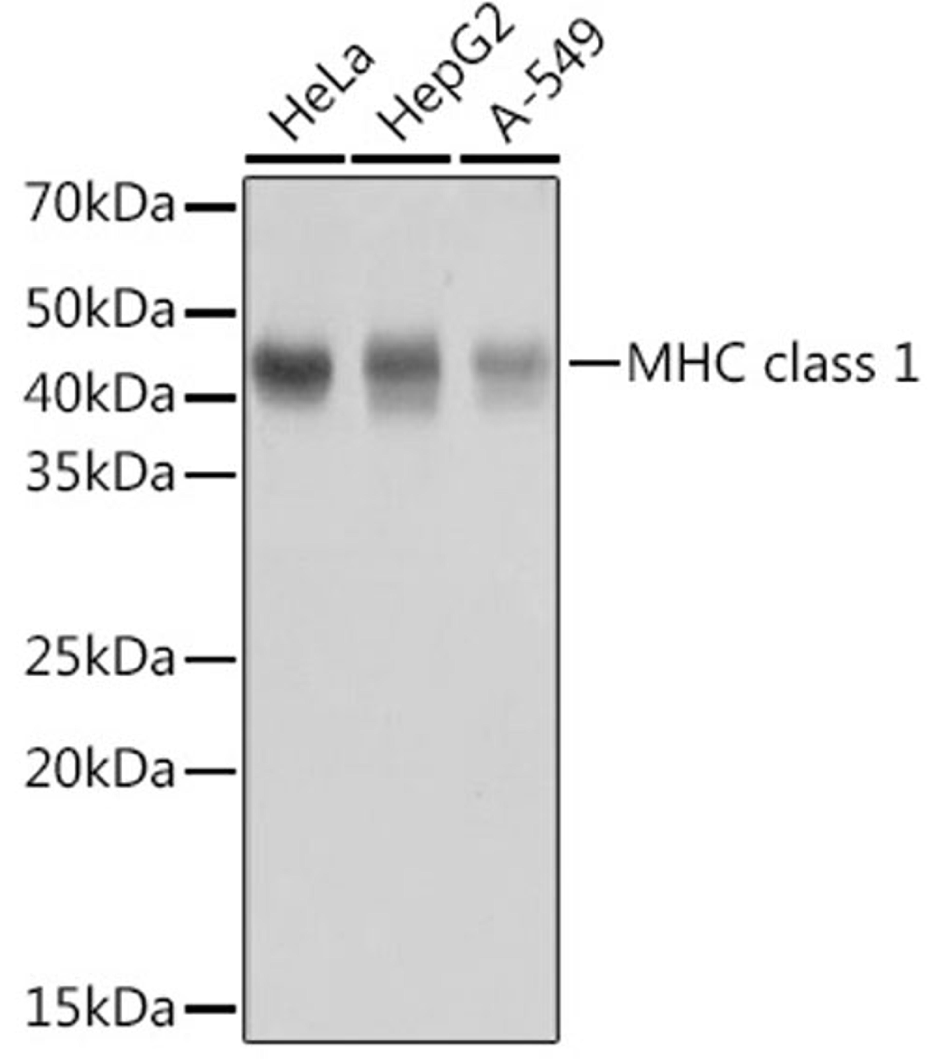 Western blot - MHC class 1 antibody (A11406)