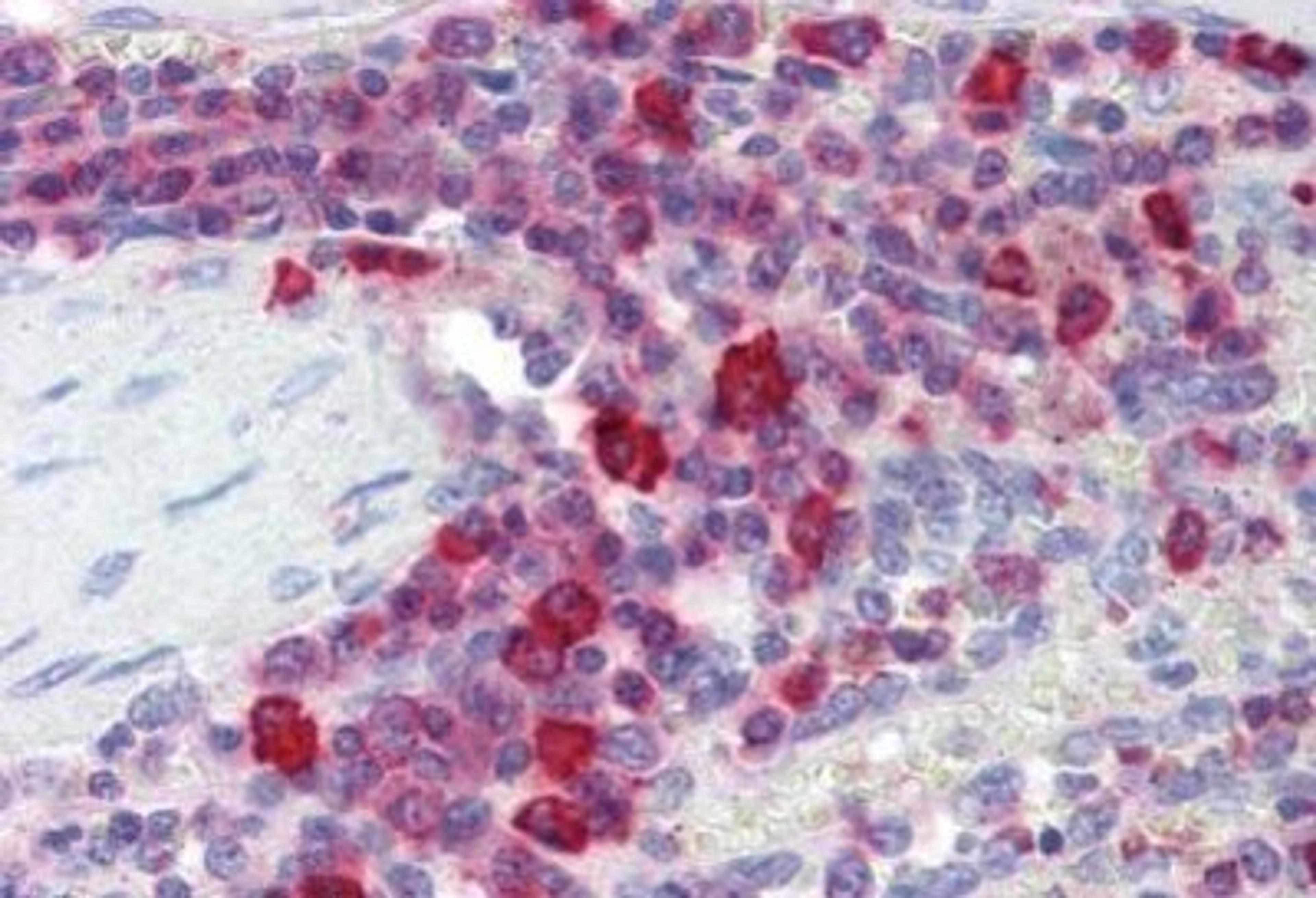 Immunohistochemistry-Paraffin: PIM3 Antibody [NBP1-50553] - Analysis of anti-PIM3 antibody with human spleen at concentration 10 ug/ml.