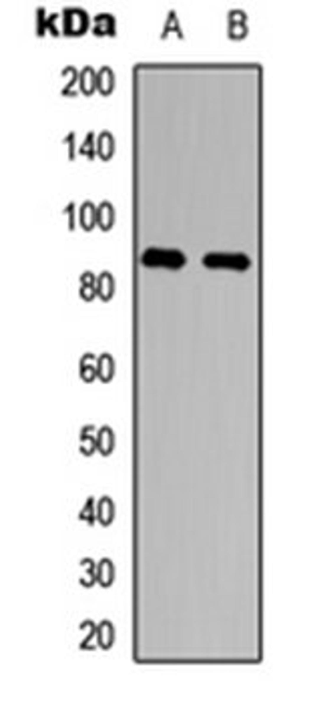 Western blot analysis of HEK293T (Lane 1), PC12 (Lane 2) whole cell lysates using CD156a antibody