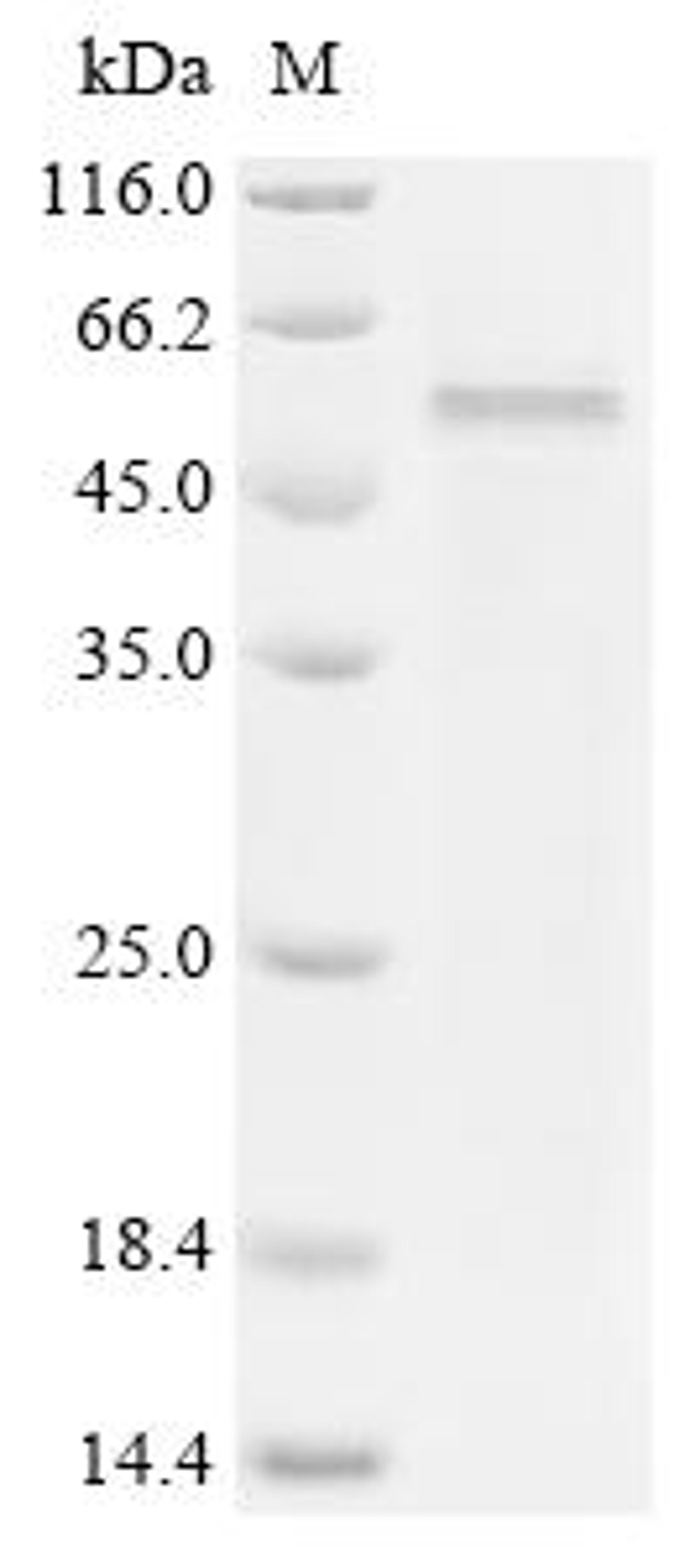 (Tris-Glycine gel) Discontinuous SDS-PAGE (reduced) with 5% enrichment gel and 15% separation gel.