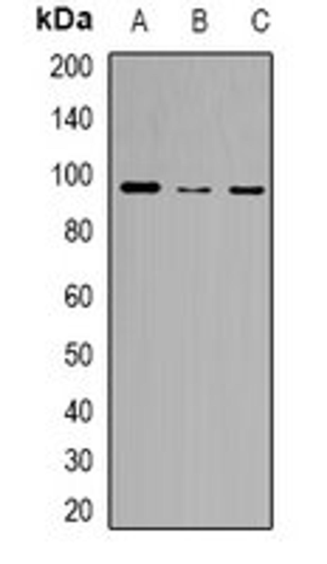 Western blot analysis of HeLa (Lane1), RAW264.7 (Lane2), H9C2 (Lane3) whole cell lysates using ZKSCAN5 antibody