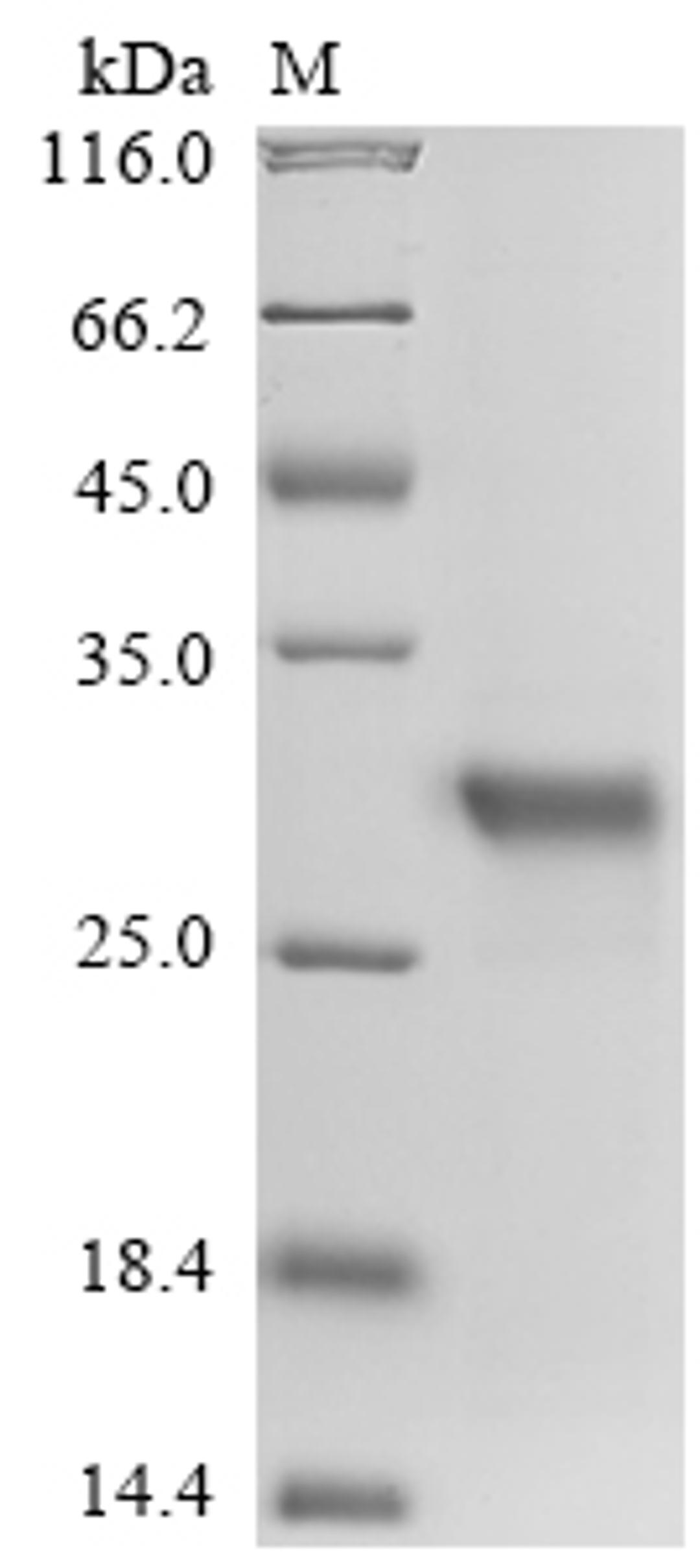 (Tris-Glycine gel) Discontinuous SDS-PAGE (reduced) with 5% enrichment gel and 15% separation gel.